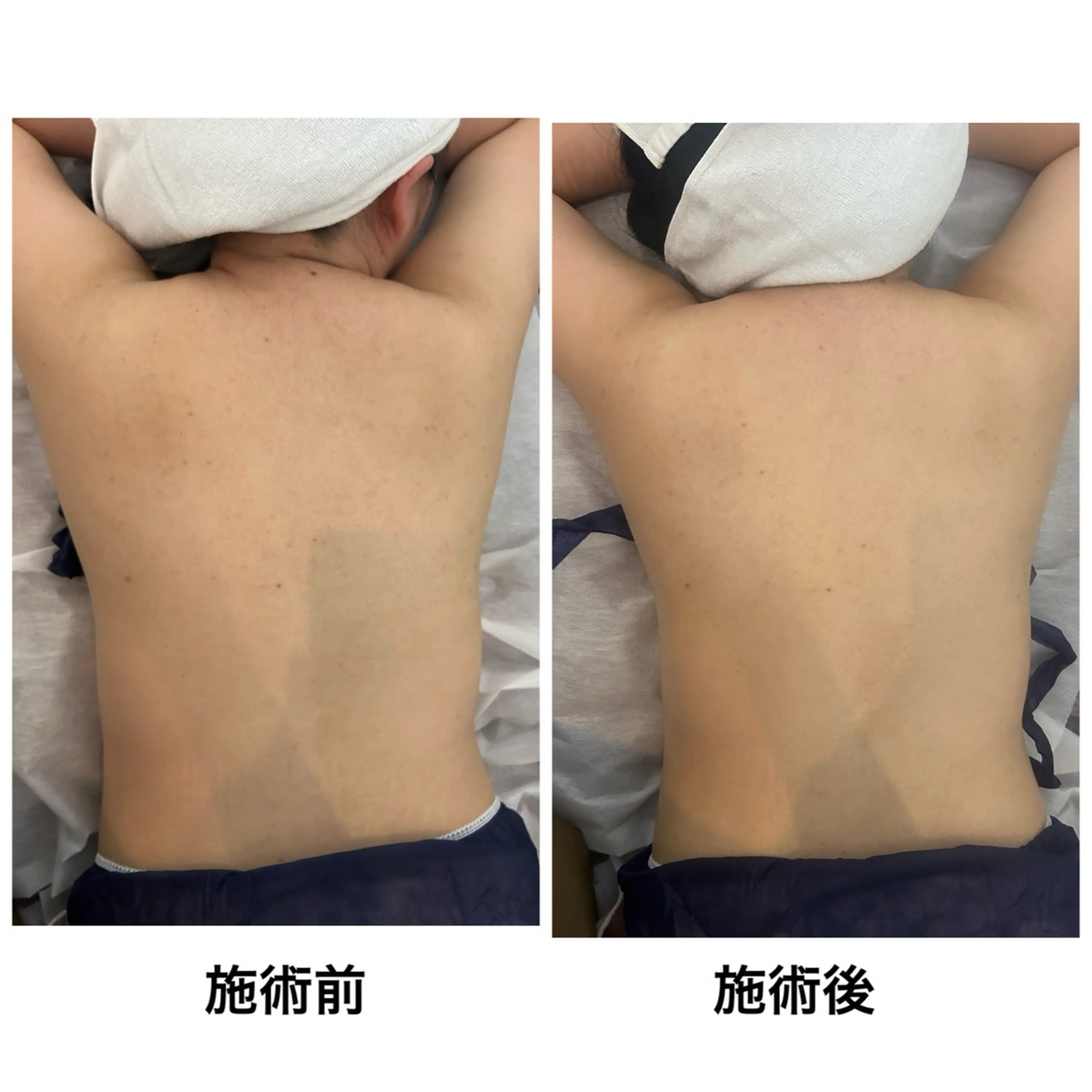 【癒されたい方必見‼️】全身の血行を良くし老廃物をお身体の外へ✨オールハンド全身ボディートリートメントの写真