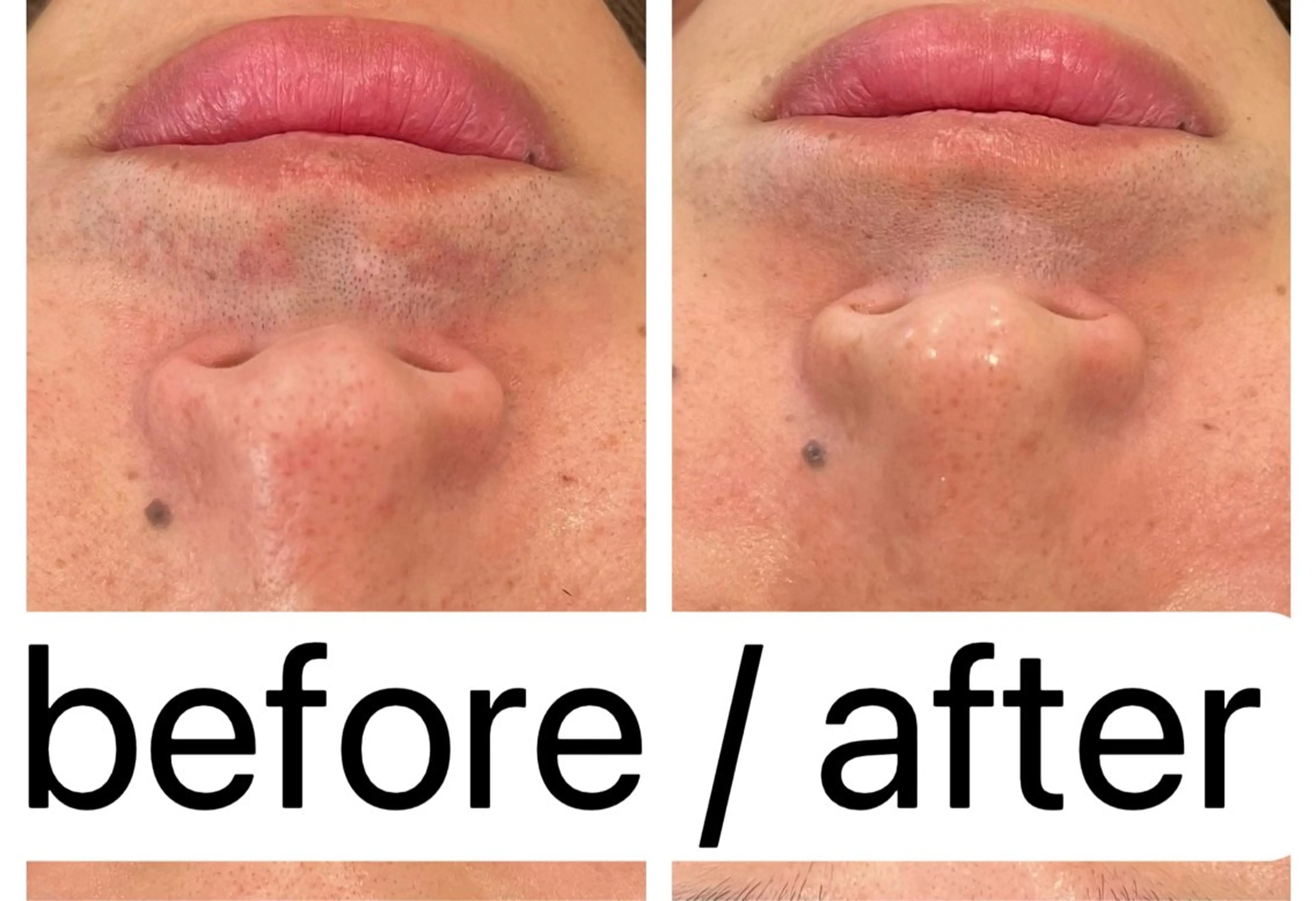 Belle原宿所属・佐藤 加奈のエステ・リラクイメージ