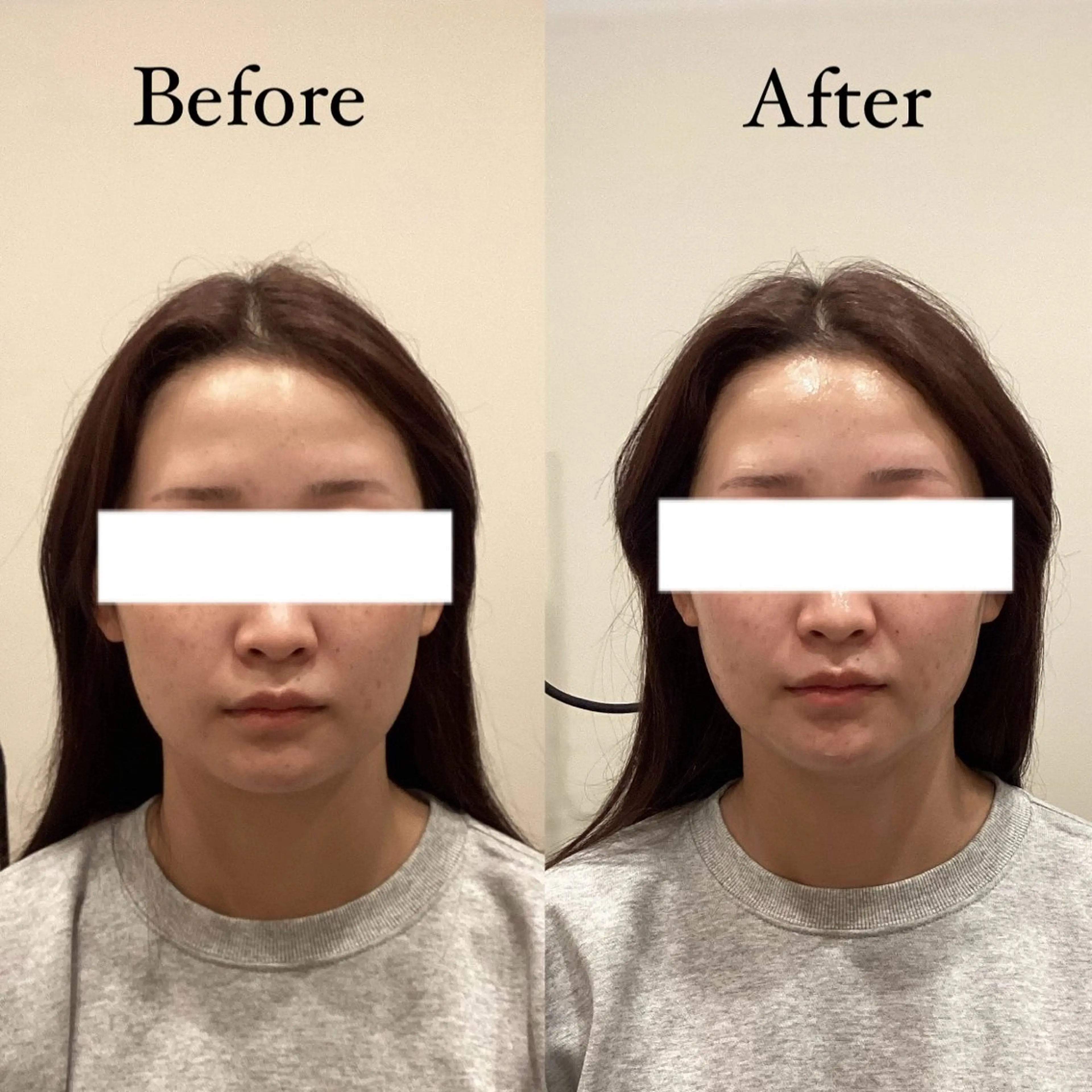 seika🍒 ハリラウンジ梅田のエステ・リラクイメージ