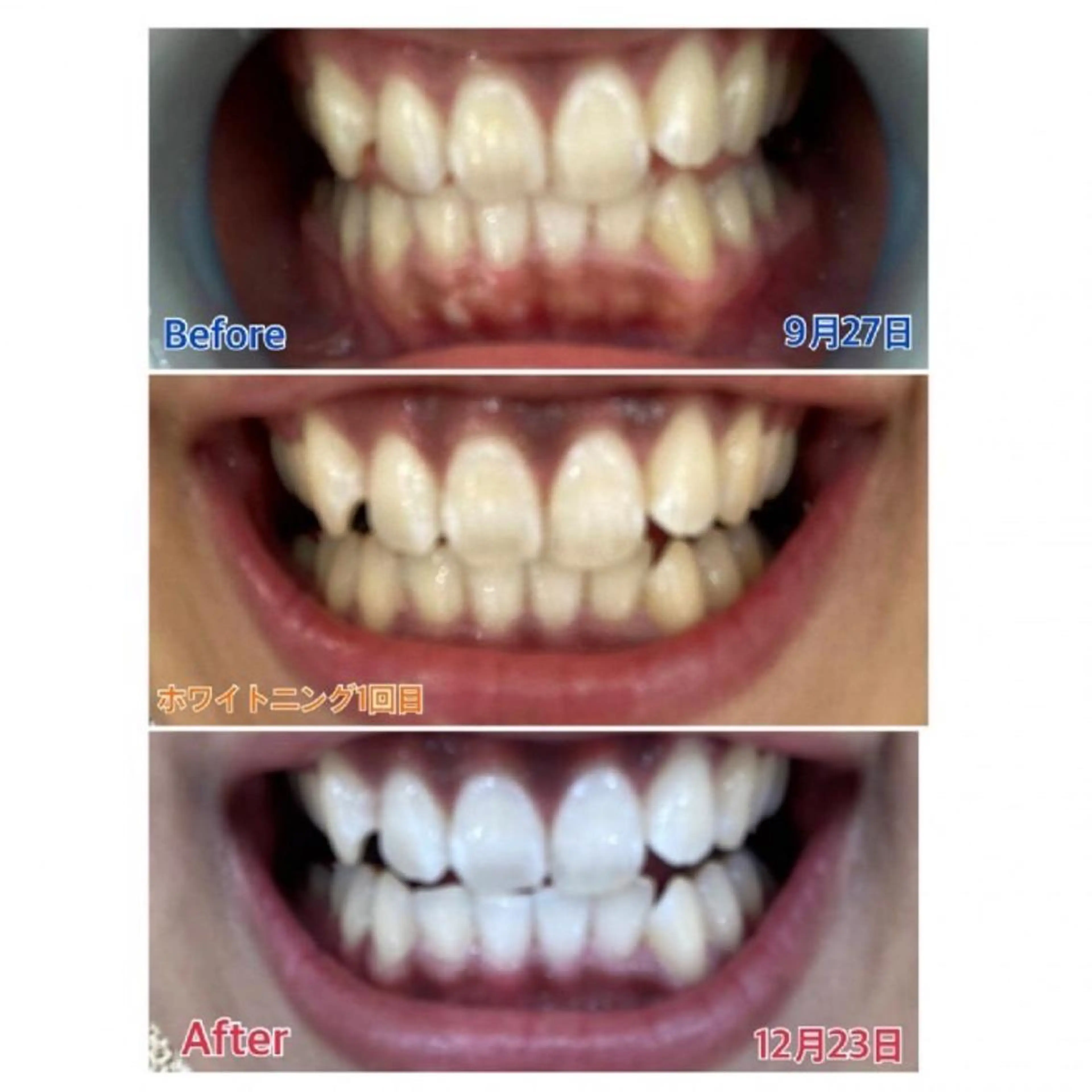 M渋谷 ホワイトニングのエステ・リラクイメージ