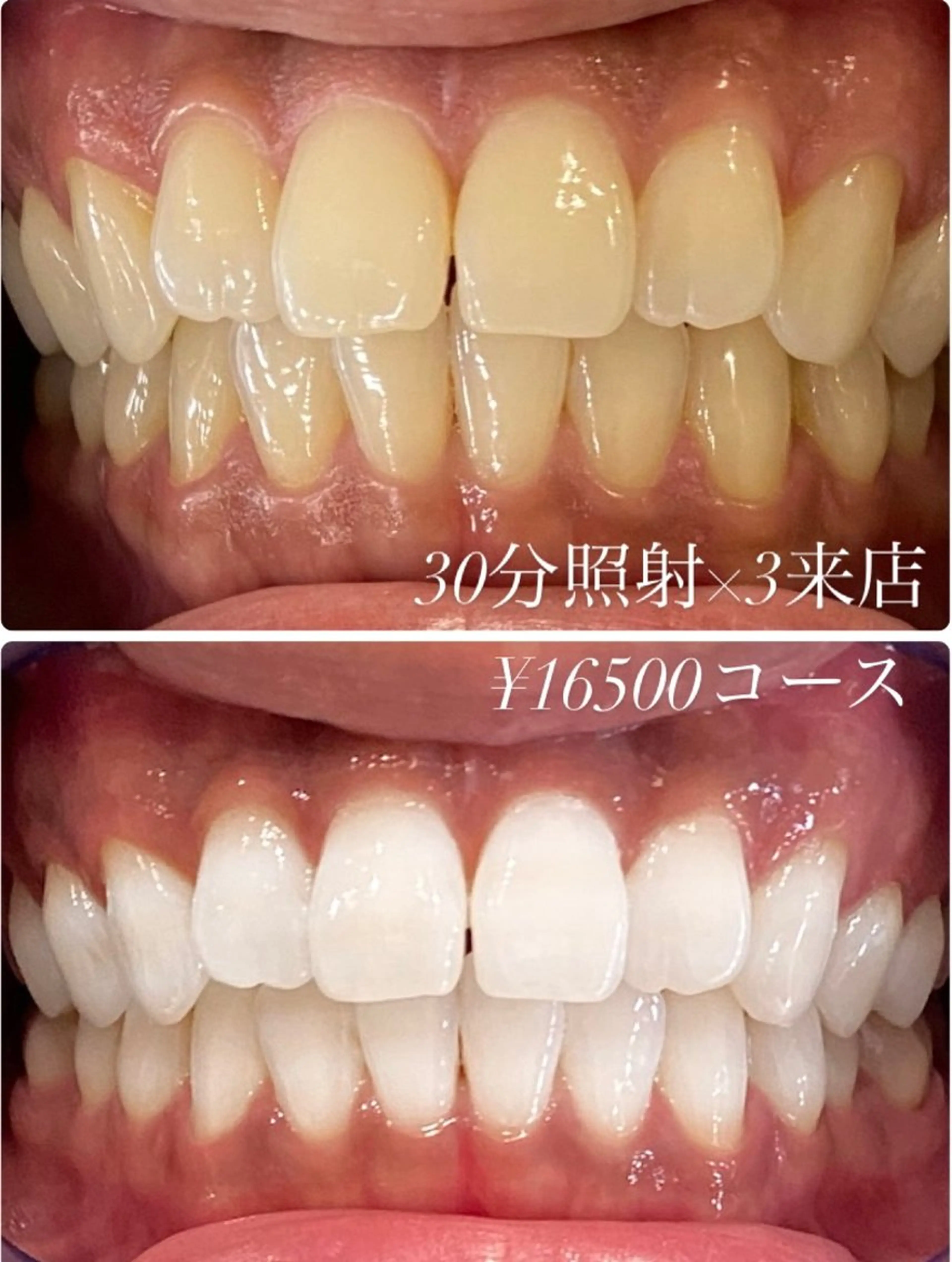 その他 ホワイトニング ルーム　川崎店のその他イメージ