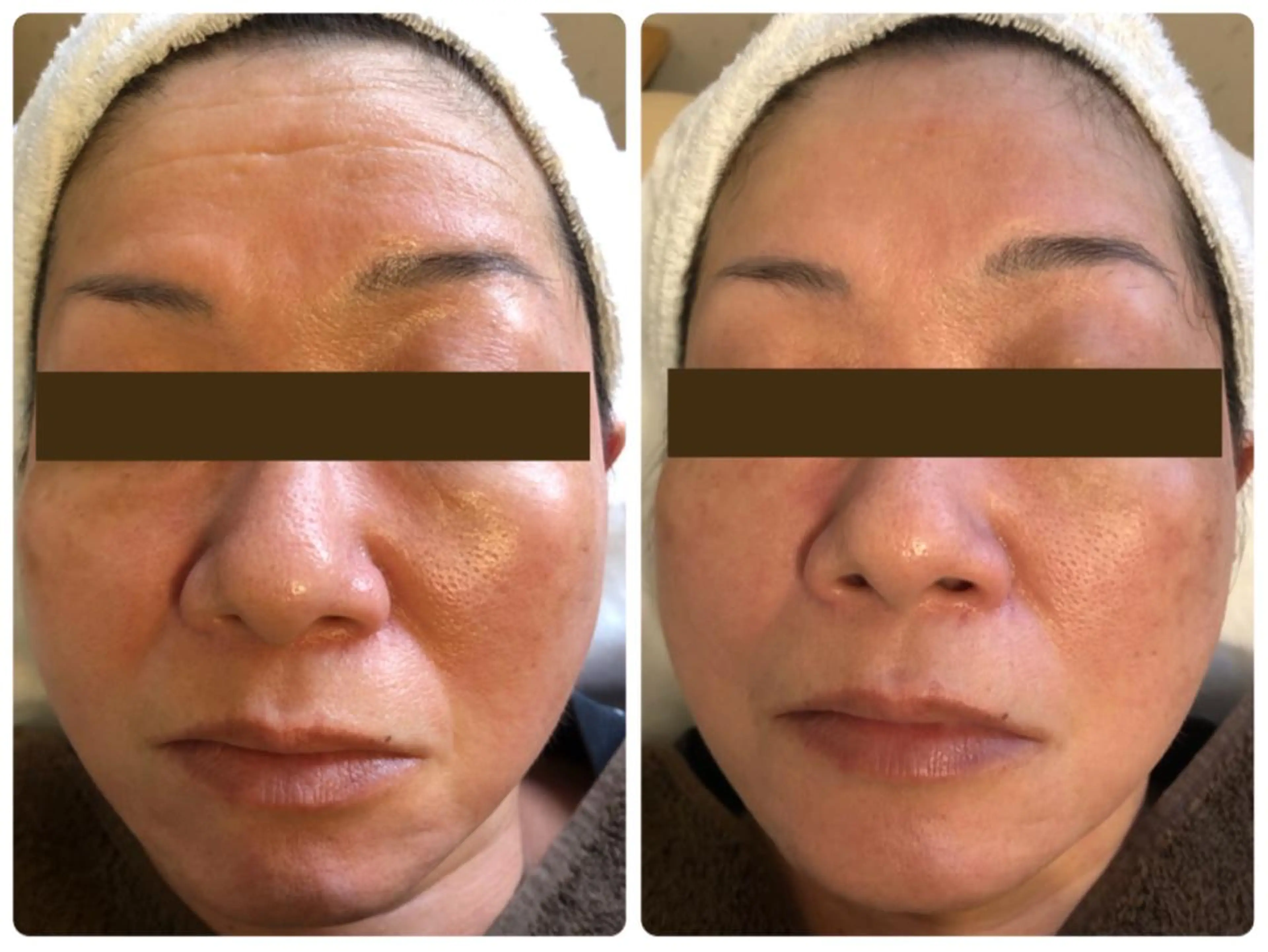 美肌サロン Lei-lani💖のエステ・リラクイメージ