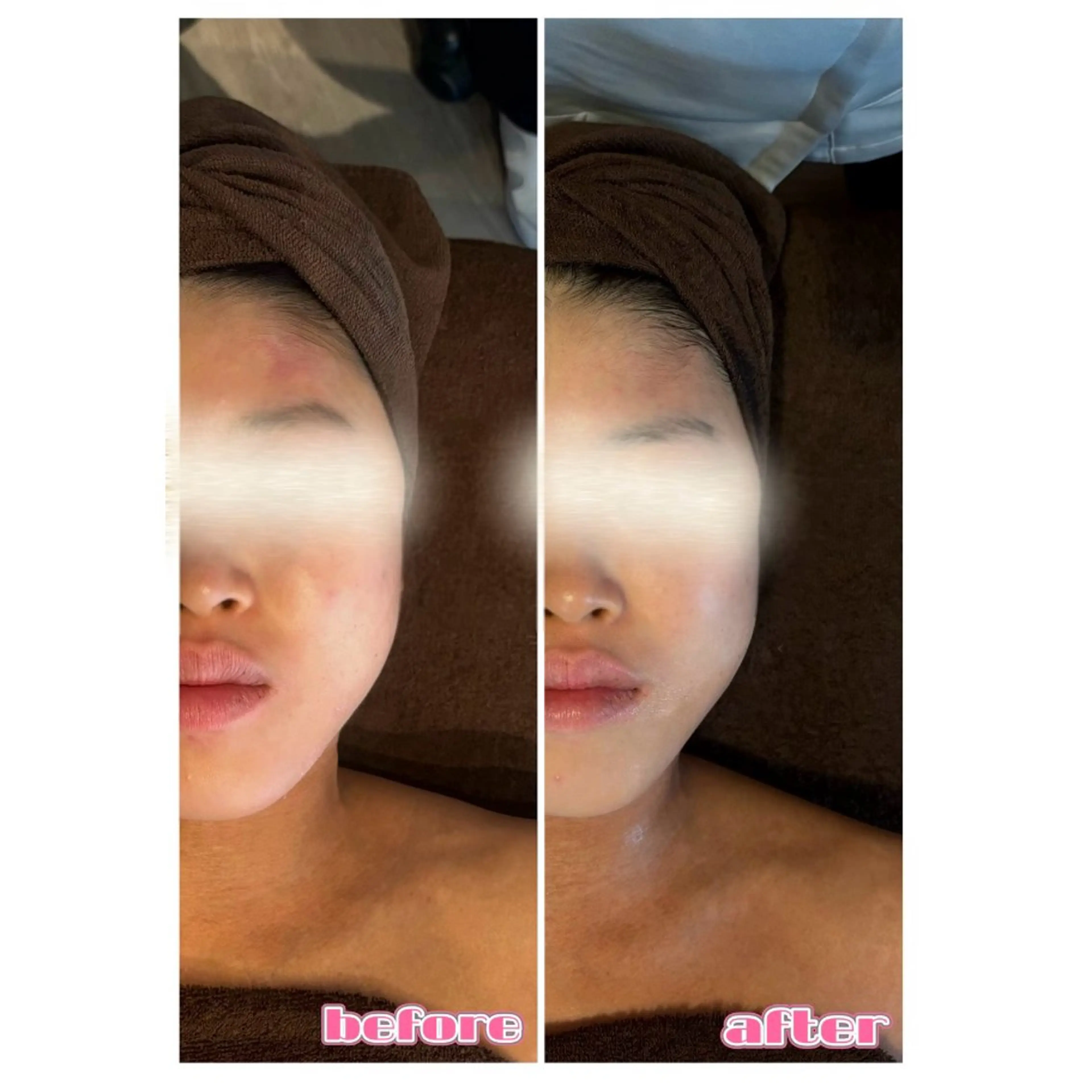 MIRAI小顔 栄店のエステ・リラクイメージ