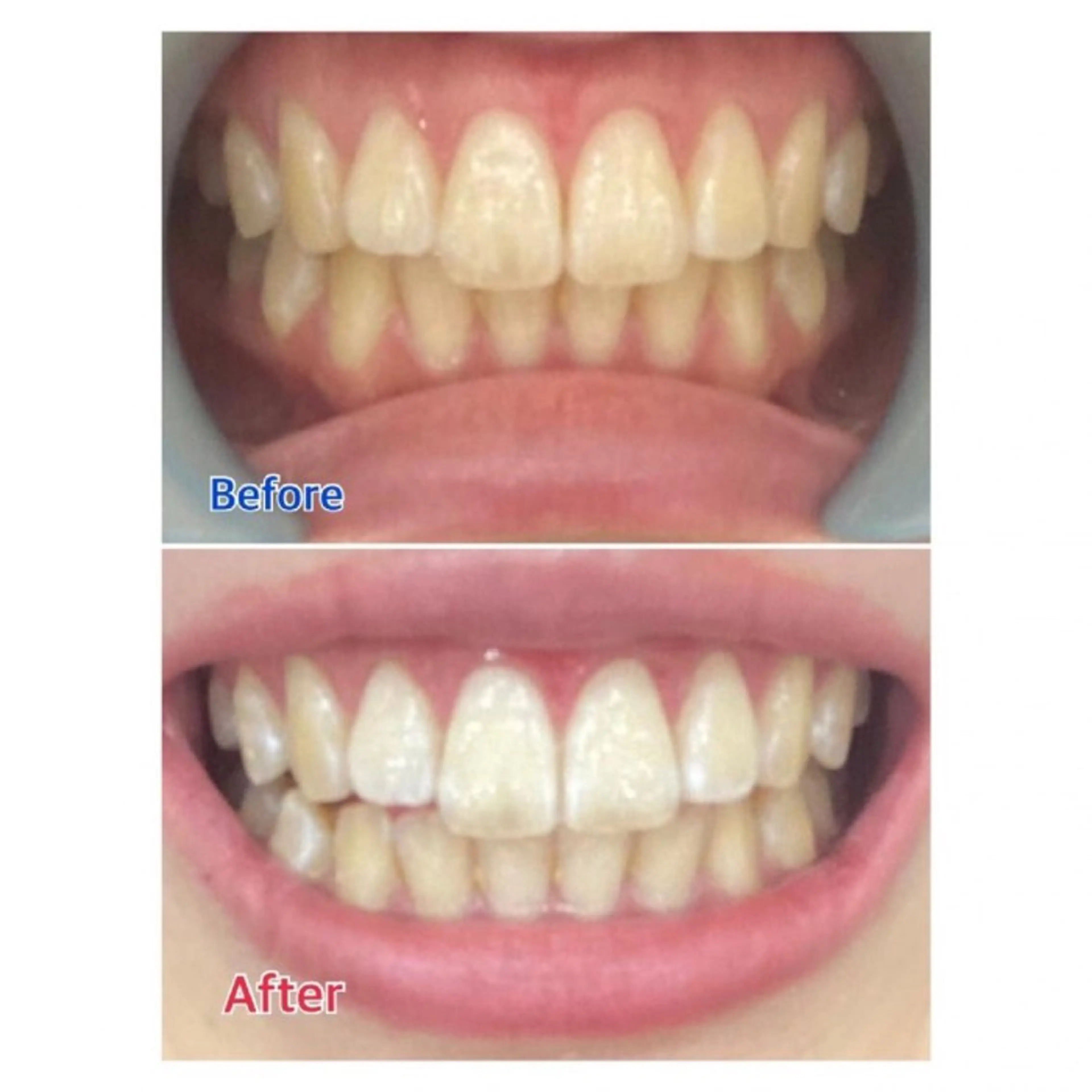 Ｍ渋谷 ホワイトニングのエステ・リラクイメージ