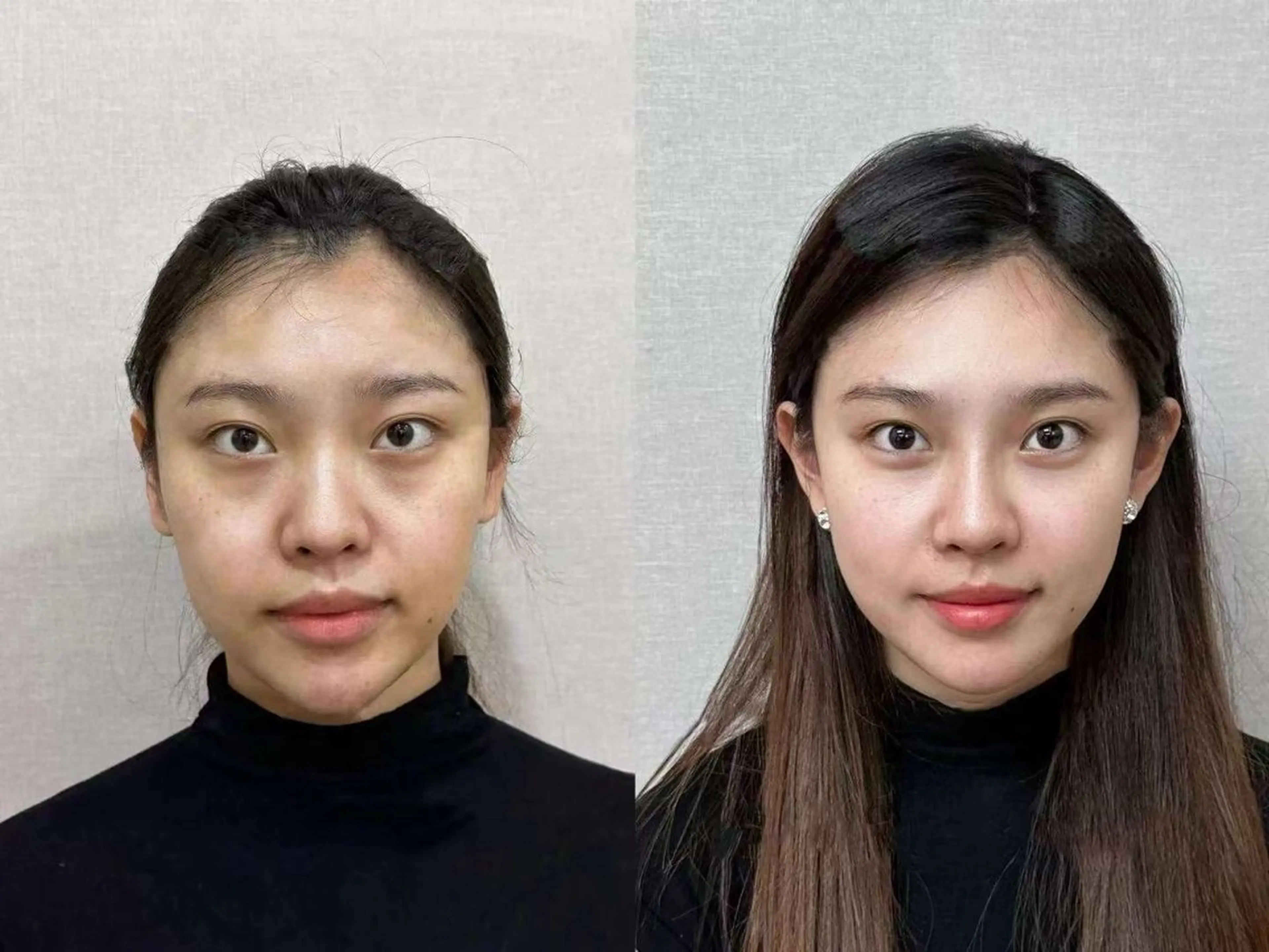 ネイル ブライダルネイル ホワイト エステ aliaハーブ水光店 エステティシャン募集のエステ・リラクイメージ