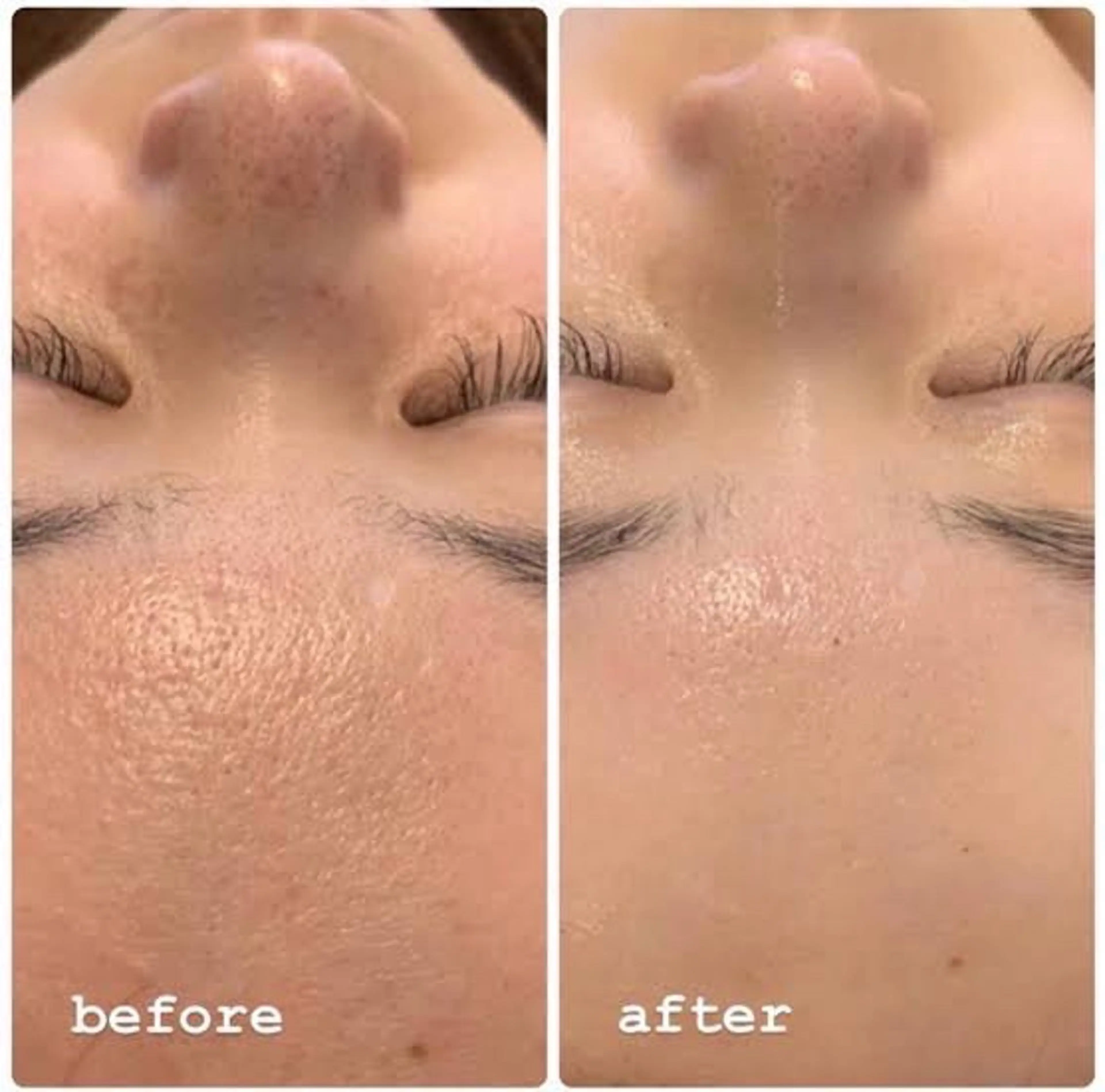 エステ リラク ハーブピーリング/ 上本町/美肌/幹細胞のエステ・リラクイメージ