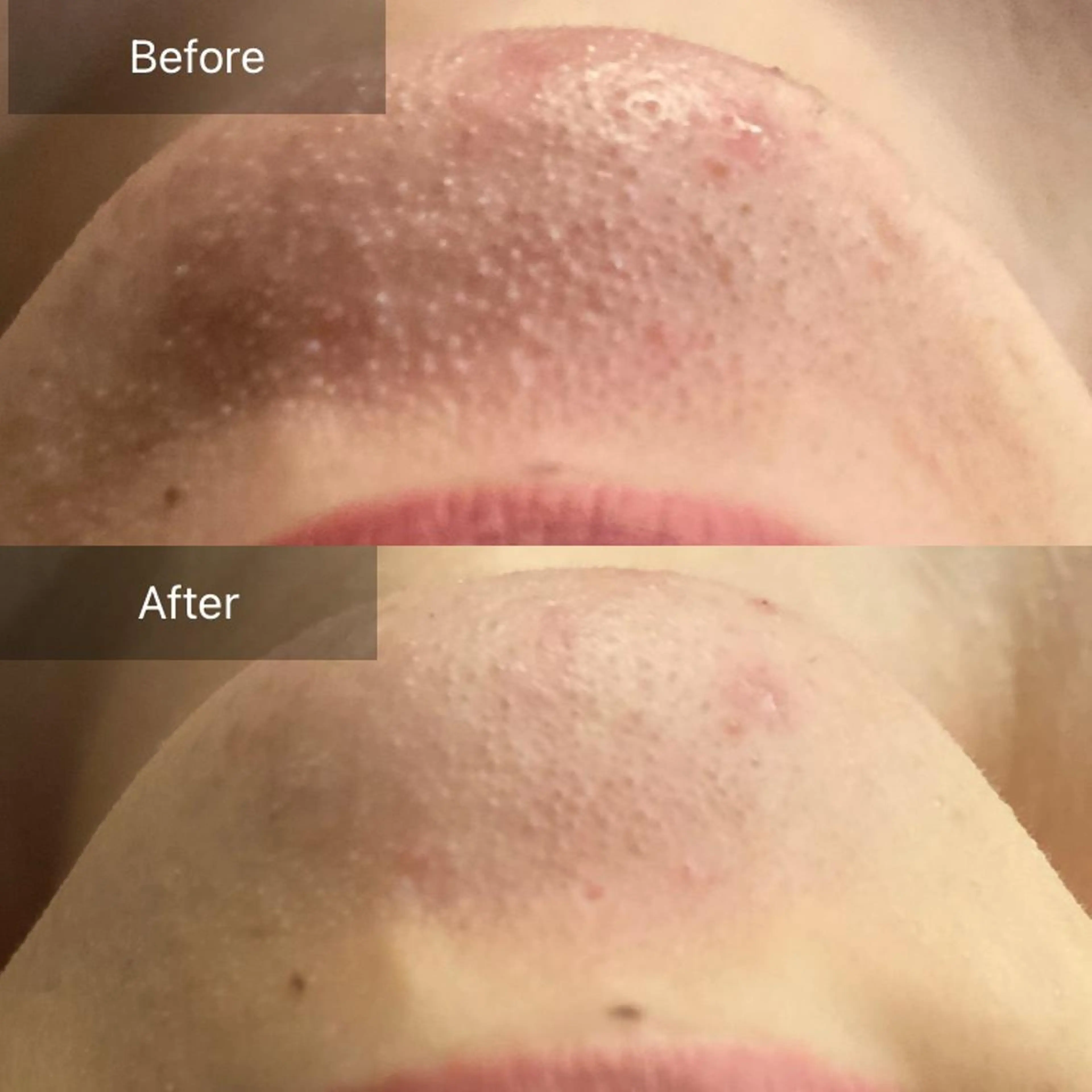 Mandarin Orange所属・毛穴から始める肌メン テマンダリンオレンジのエステ・リラクイメージ