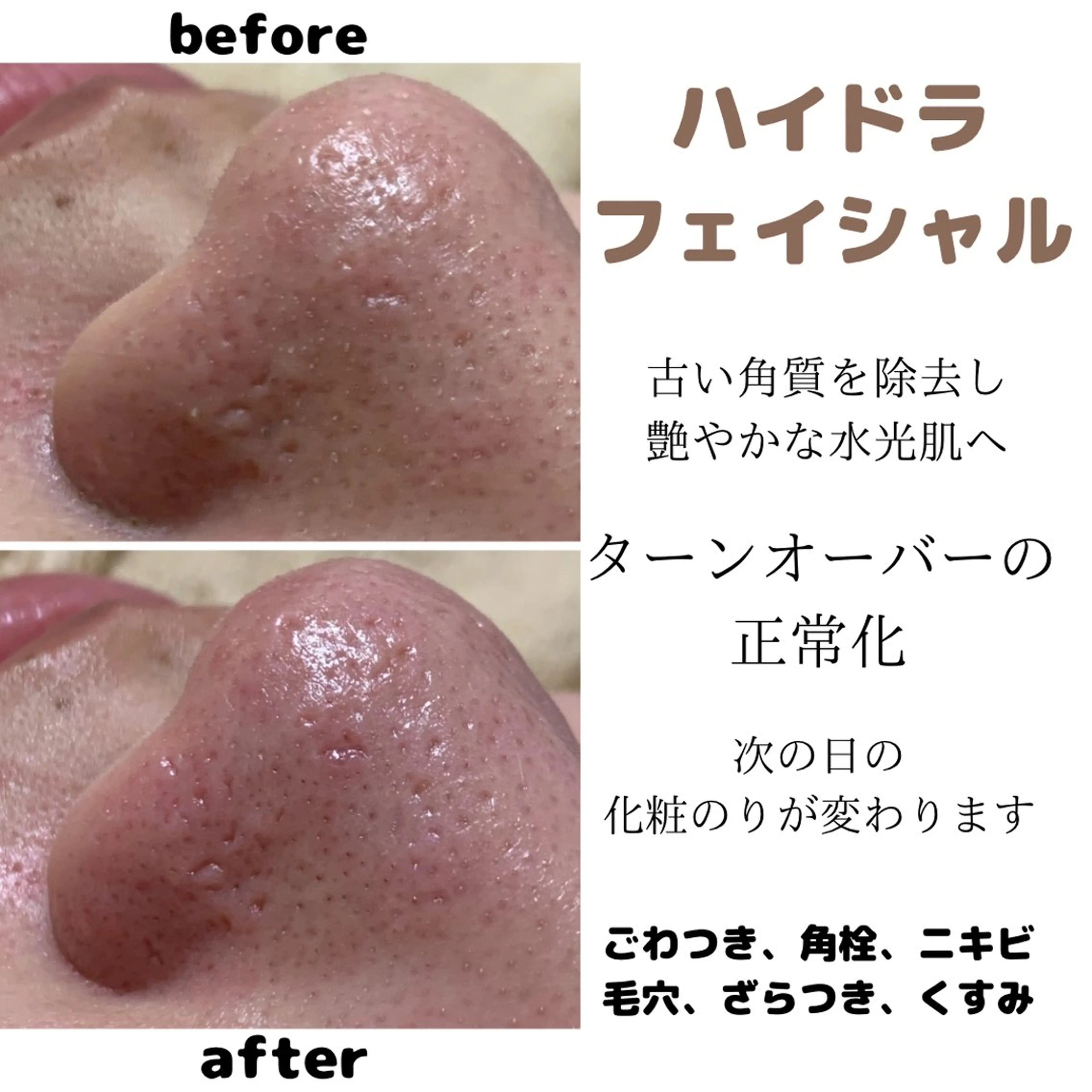 プライベートサロンCuara所属・プライベートサロン Cuaraのエステ・リラクイメージ