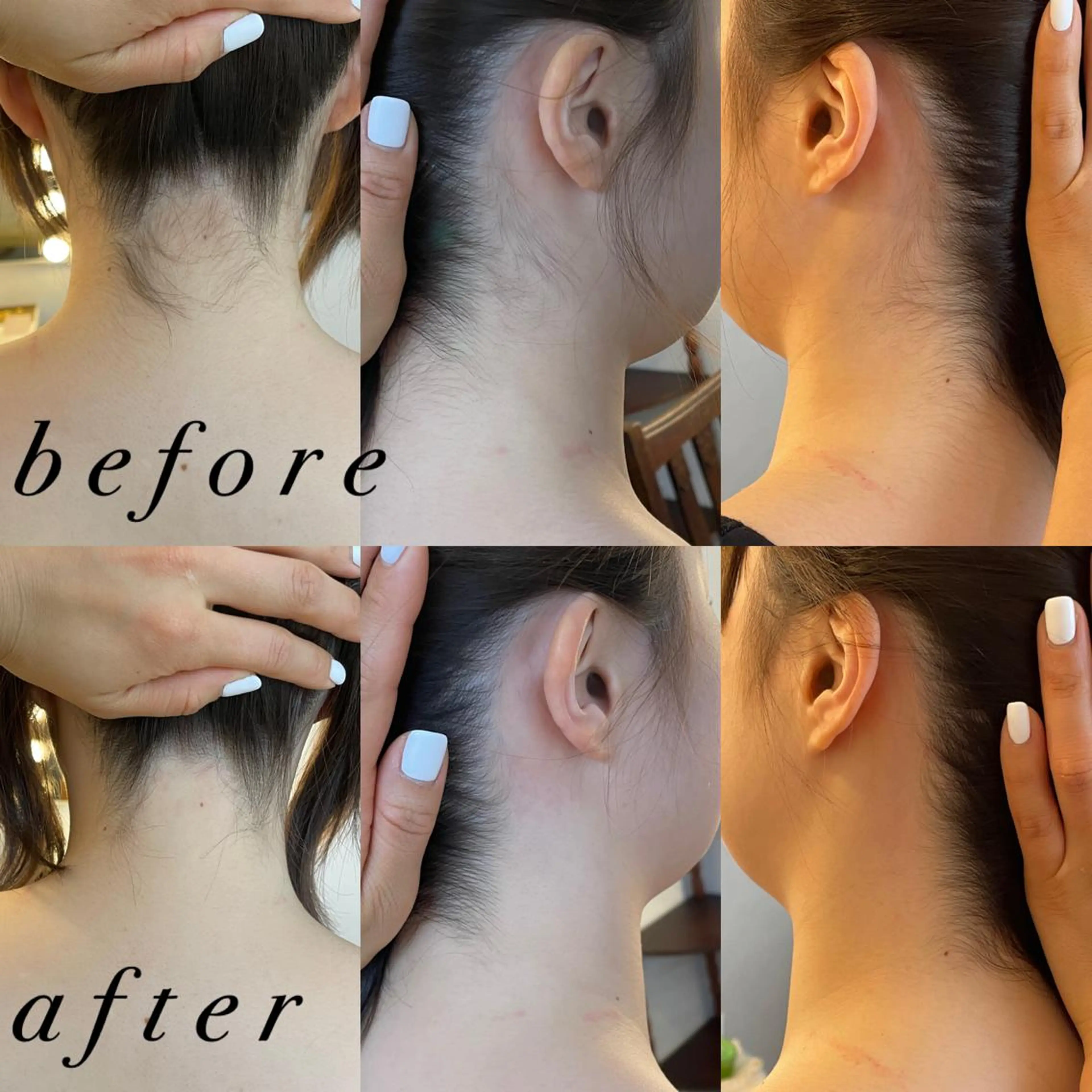 うなじ脱毛/美肌脱毛 LABELのエステ・リラクイメージ