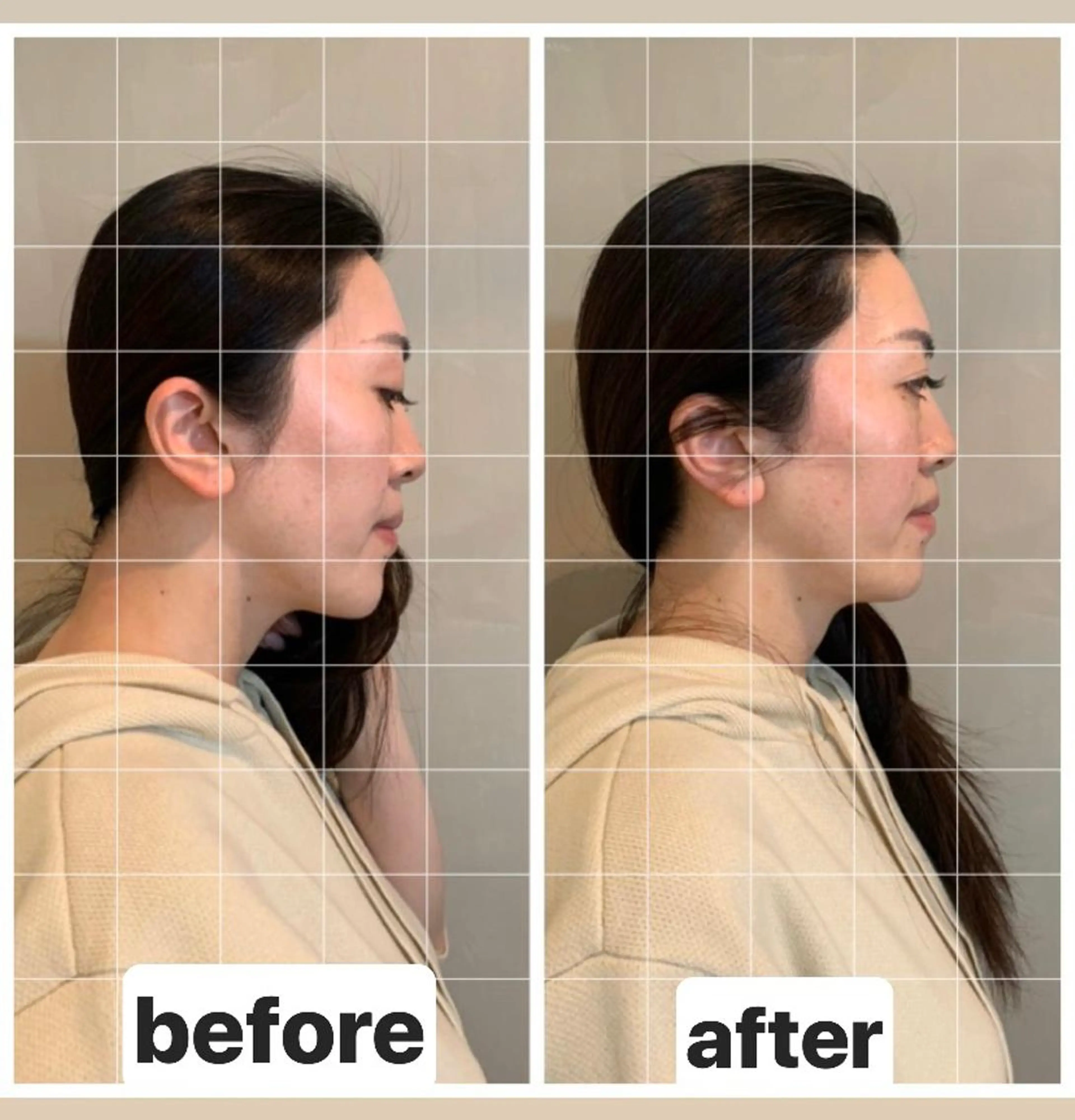 エステ リラク PARAFUSE. 新潟のエステ・リラクイメージ