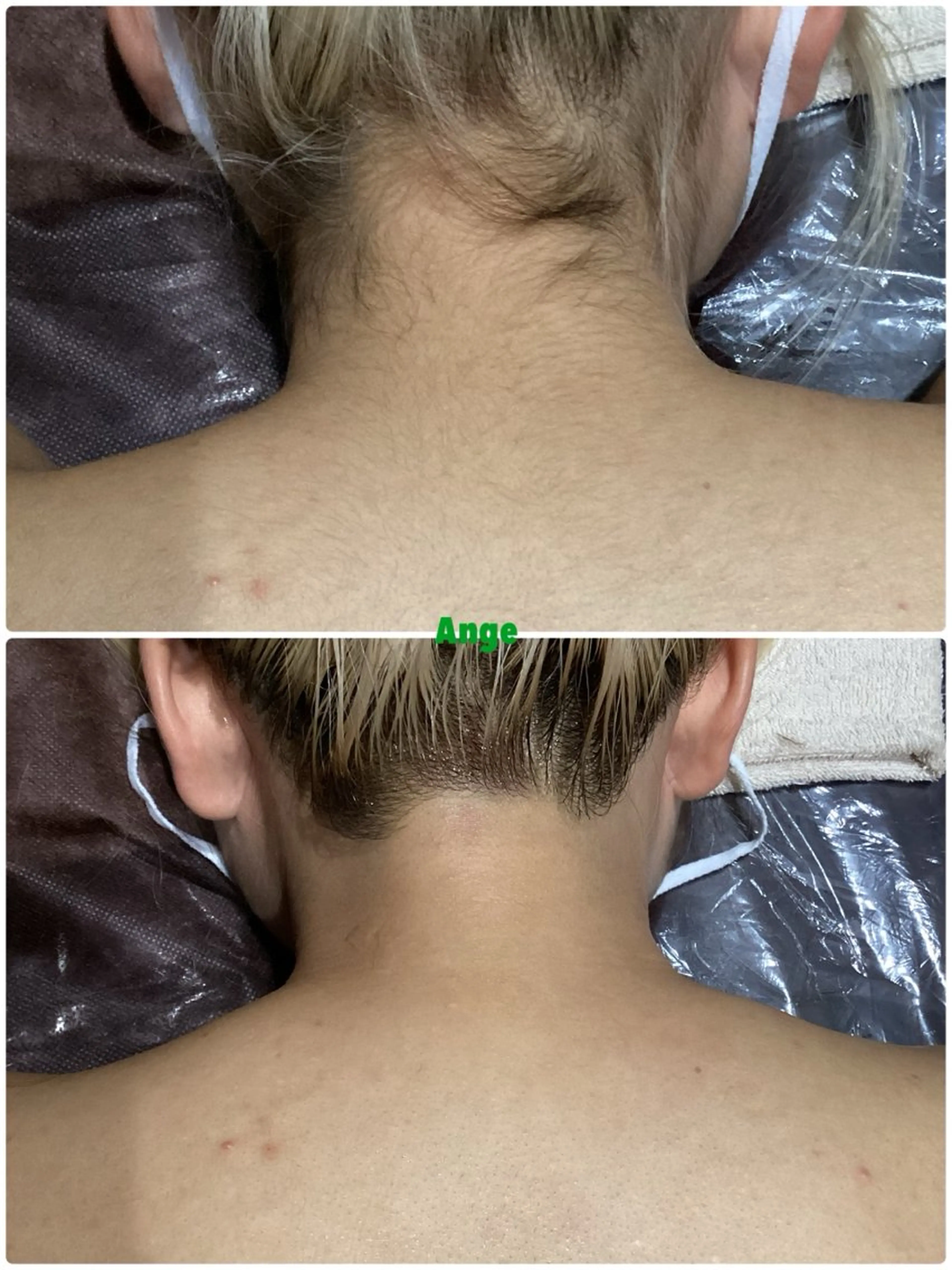 脱毛 Ange vivalavidaのエステ・リラクイメージ