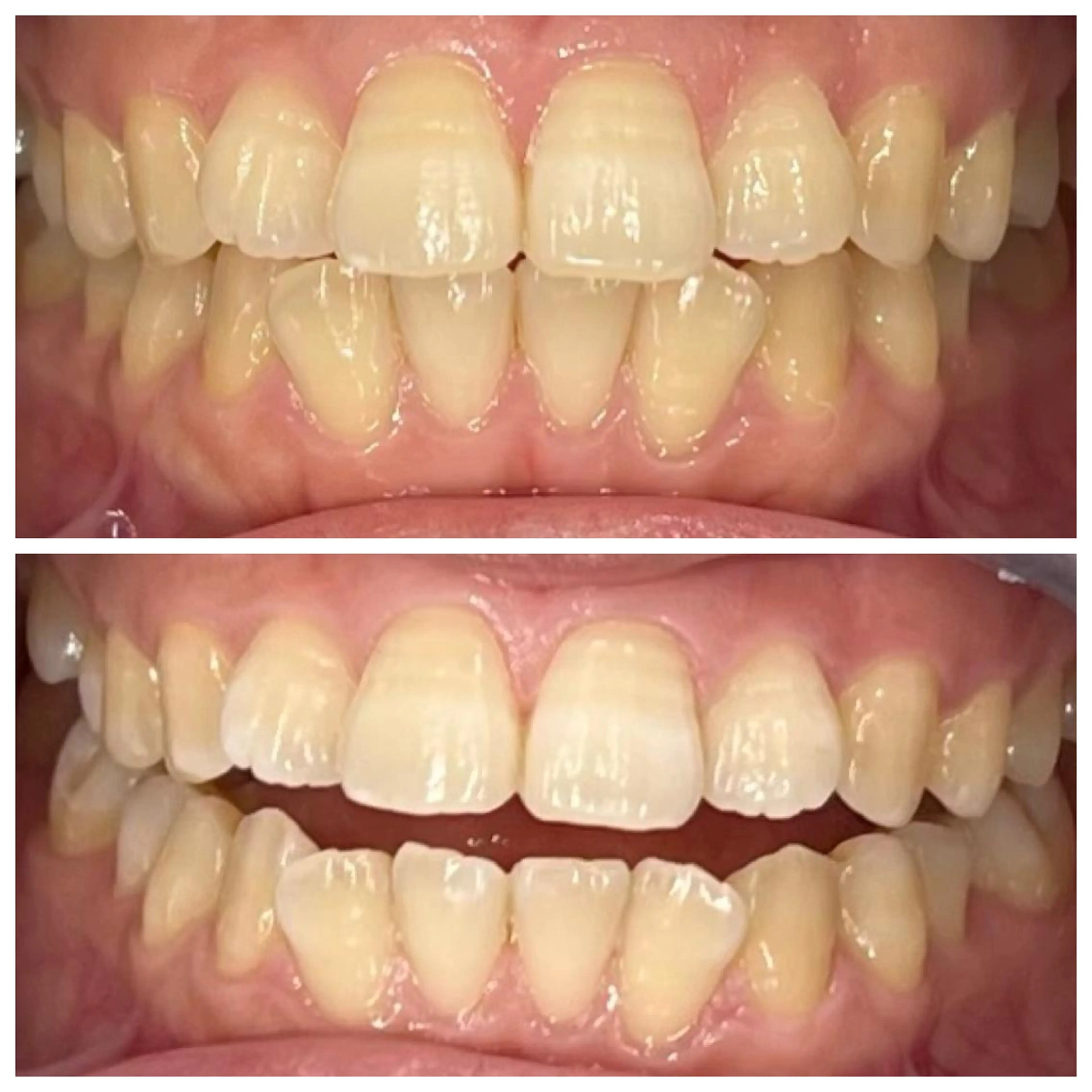 ホワイトニング🦷 ネイル💅LEAのその他イメージ