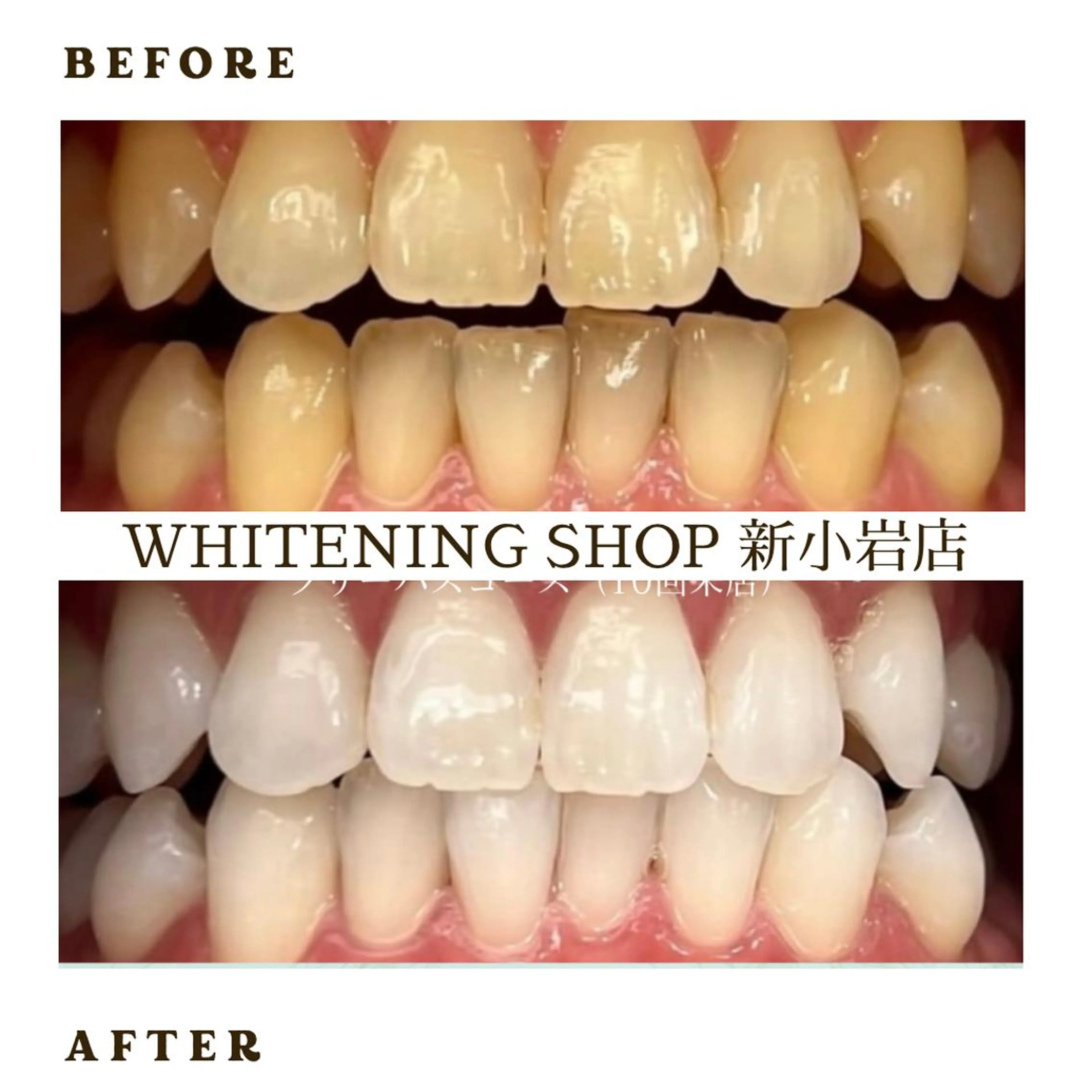 メンズ その他 ホワイトニング ショップ新小岩店のその他イメージ