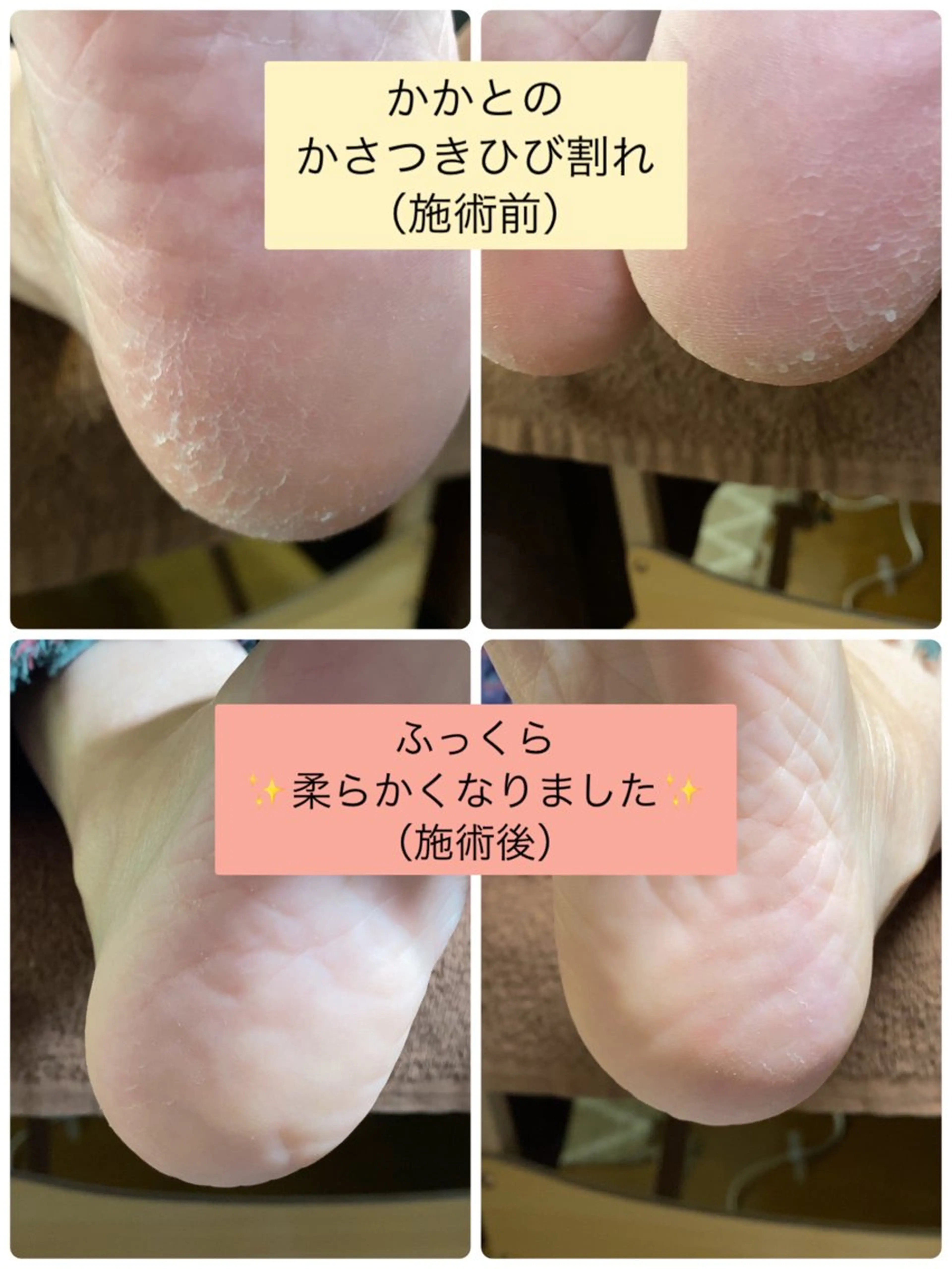 ネイル フットネイル Studio Jivanのネイルデザイン