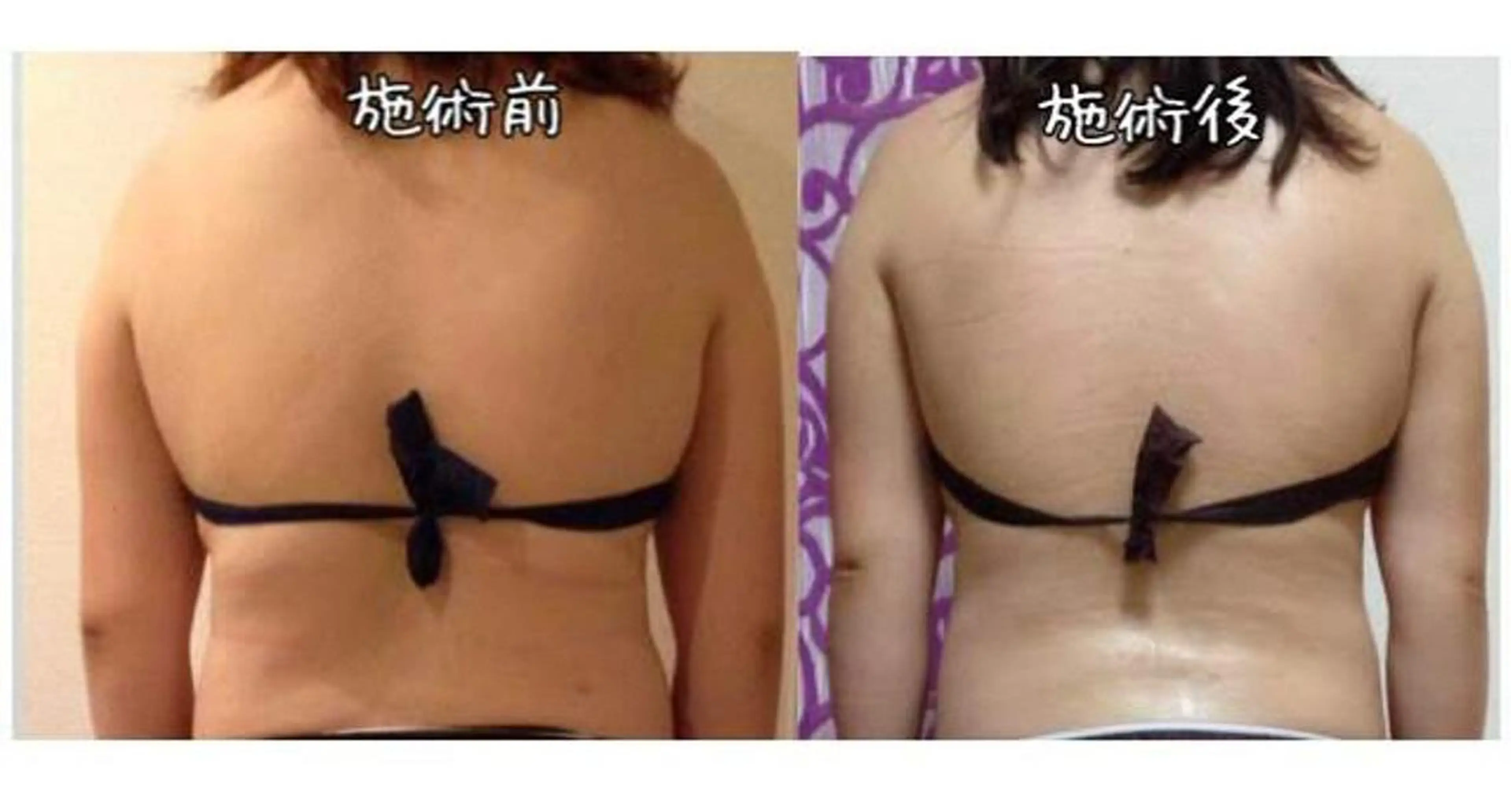 ミディアム カラー パーマ ヘアアレンジ メンズ キッズ ネイル マツエク・マツパ 強圧オールハンド痩身&黄土よもぎ蒸しプライベートサロンClematis池袋所属・強圧オールハンド痩身 片野のエステ・リラクイメージ