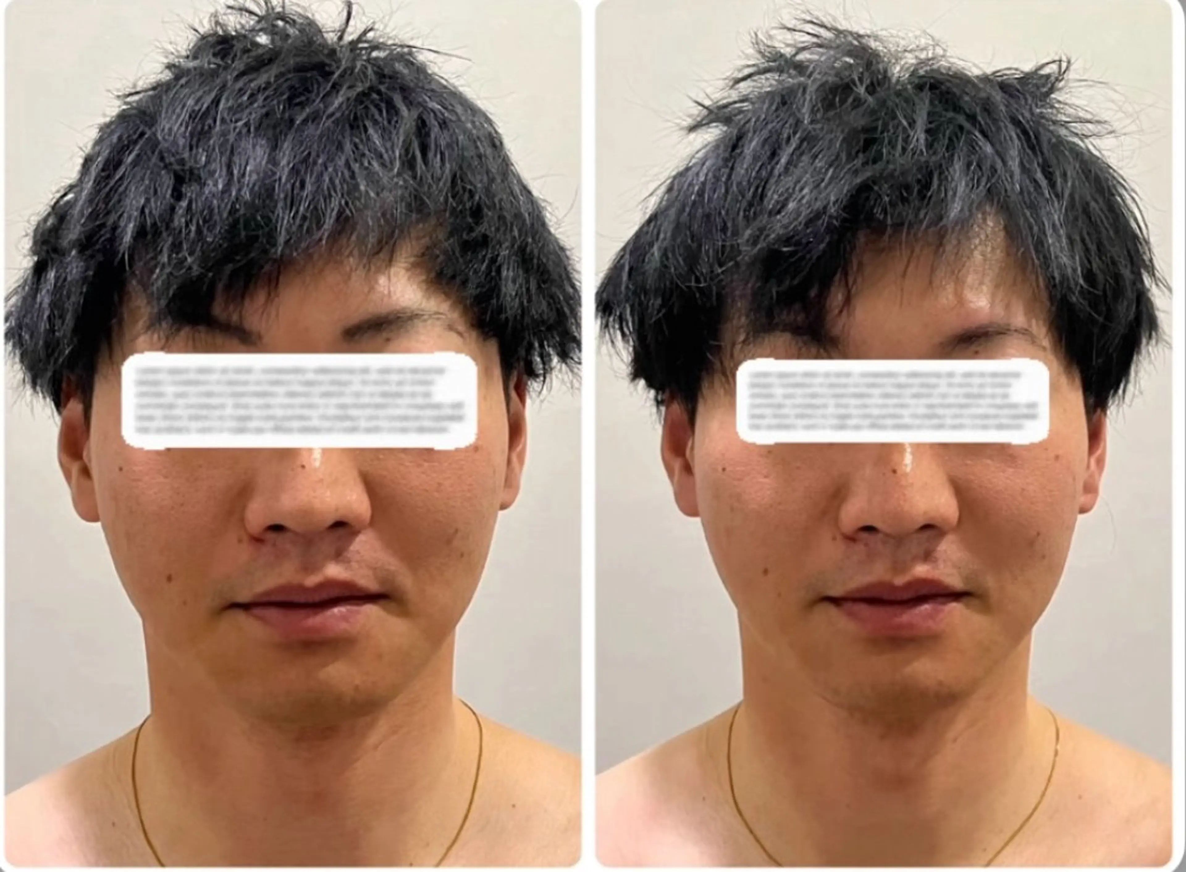 メンズ DIMENSION miyuのエステ・リラクイメージ