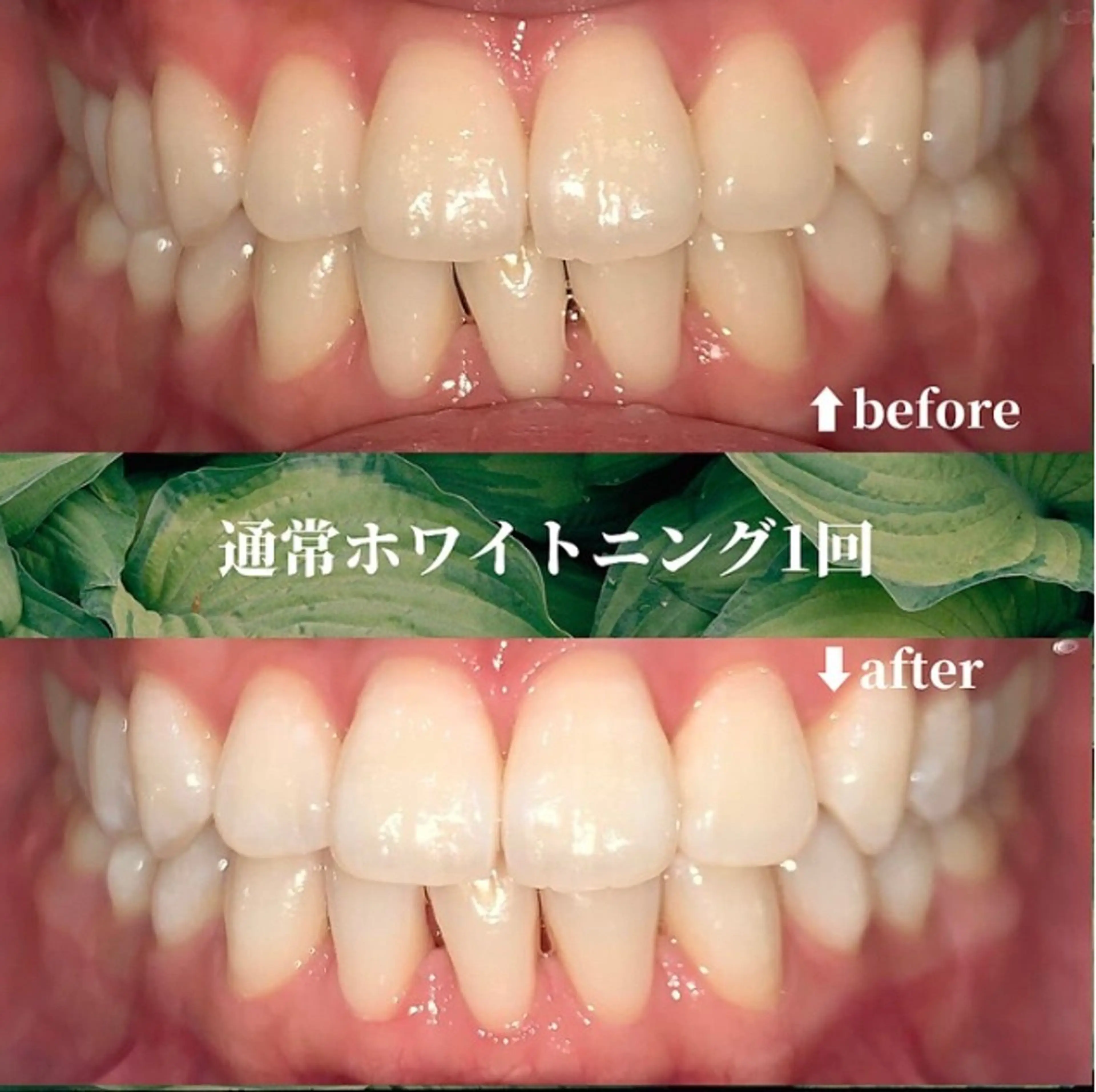 futaba ホワイトニング/天神のエステ・リラクイメージ