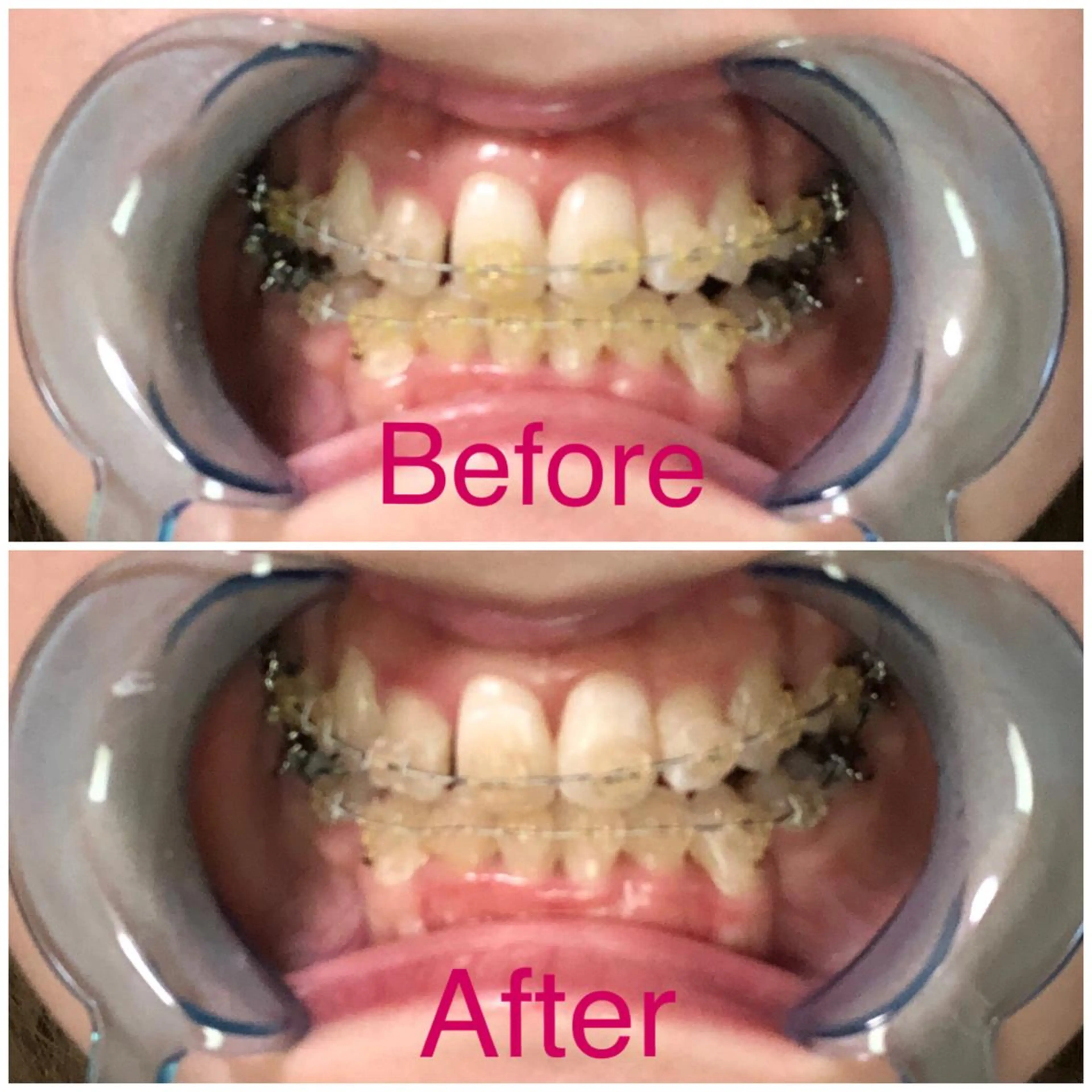 イーチブライト EachBrightのその他イメージ