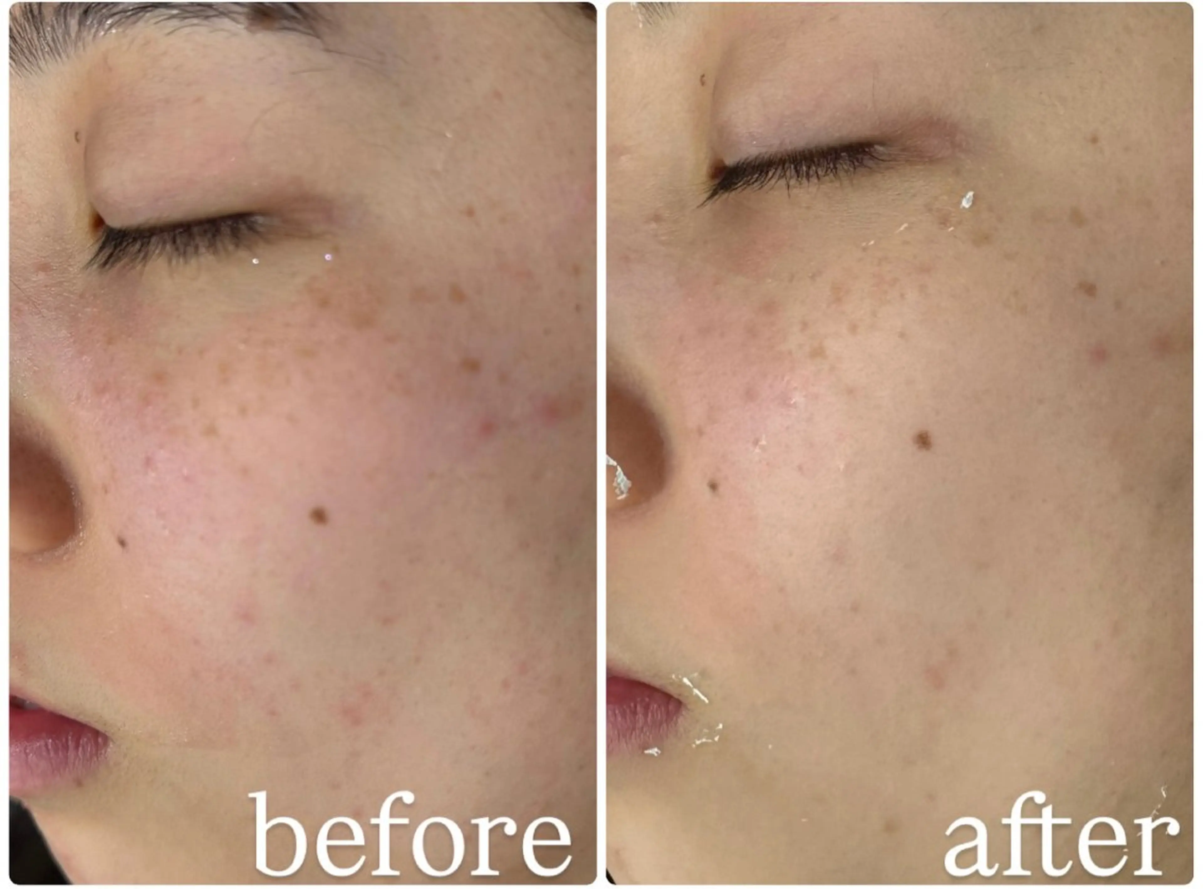 エステ クラスペディア脱毛 ・フェイシャル専門店のエステ・リラクイメージ