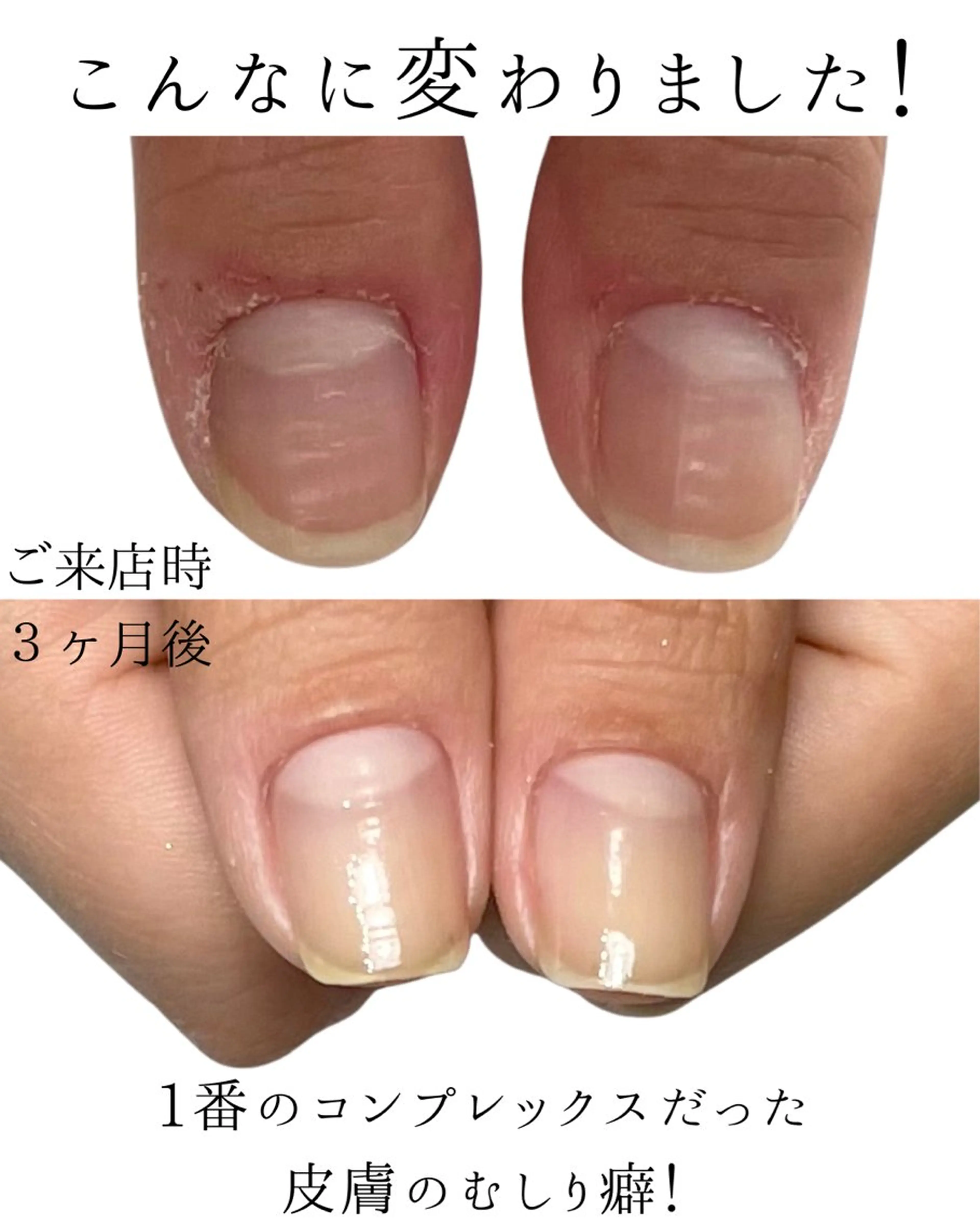 ネイル Aim* 深爪自爪育成専門店のネイルデザイン