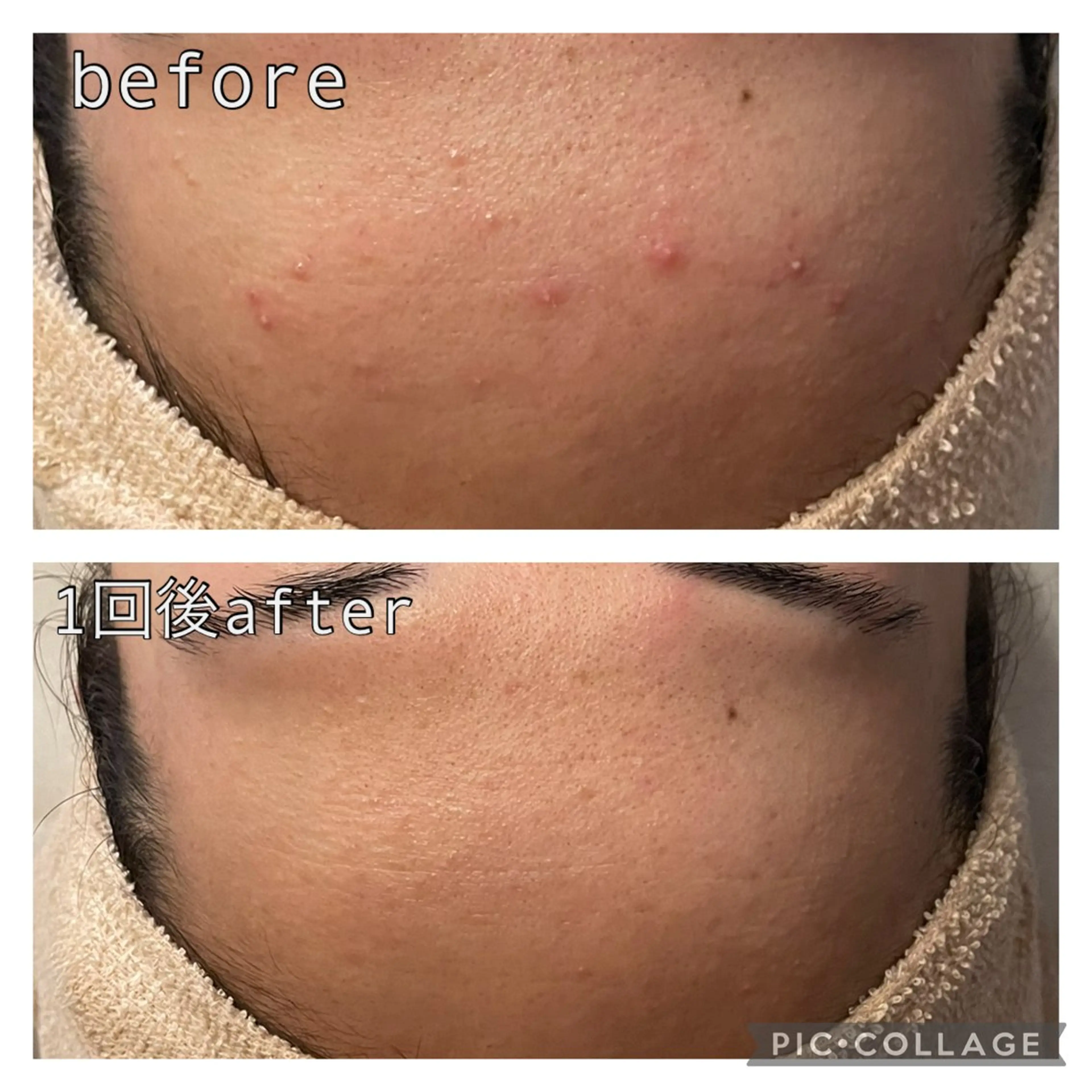 エステ 毛穴改善サロン d'Alba大阪住吉のエステ・リラクイメージ