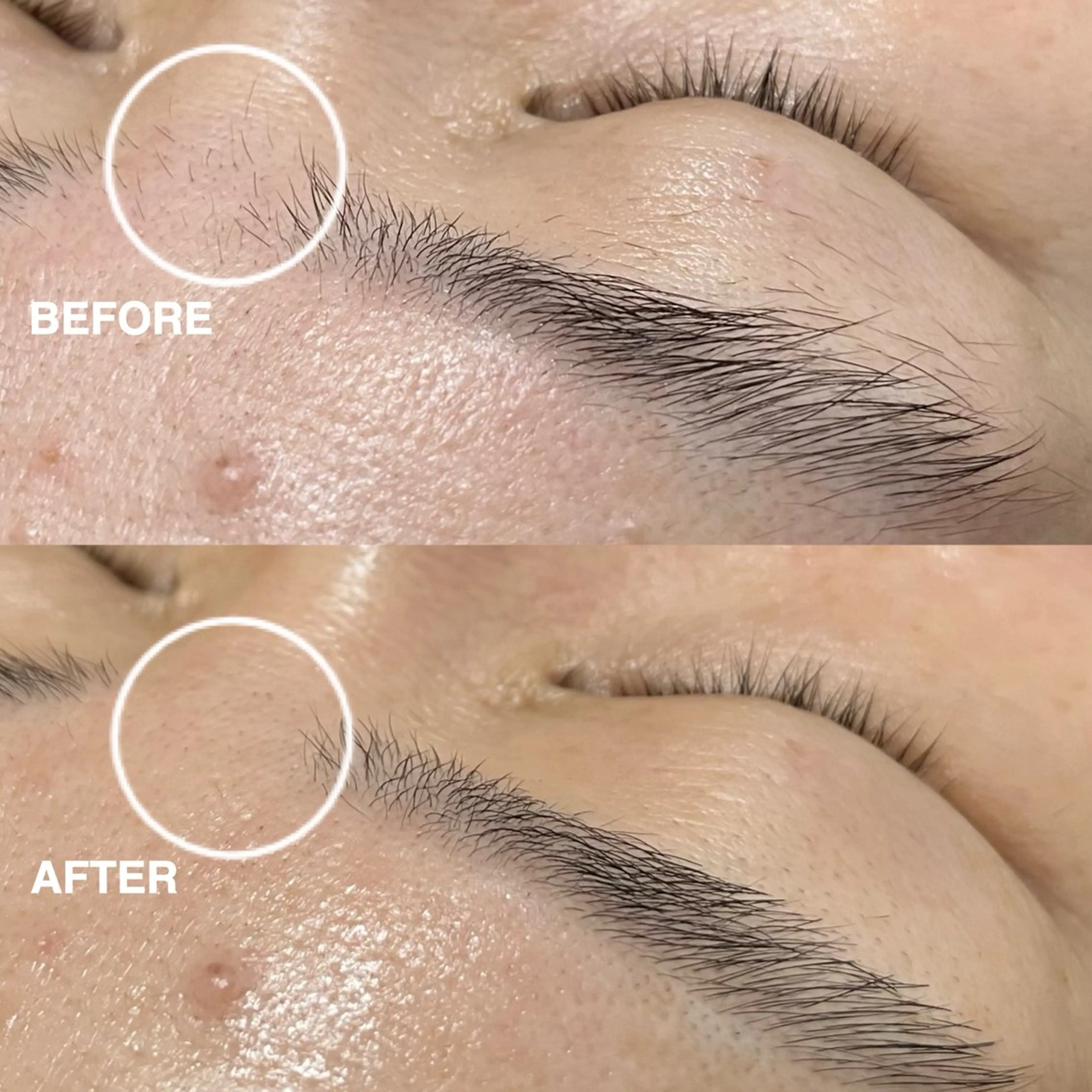 【ディープクレンジングコース】　　　※シェービング込の写真