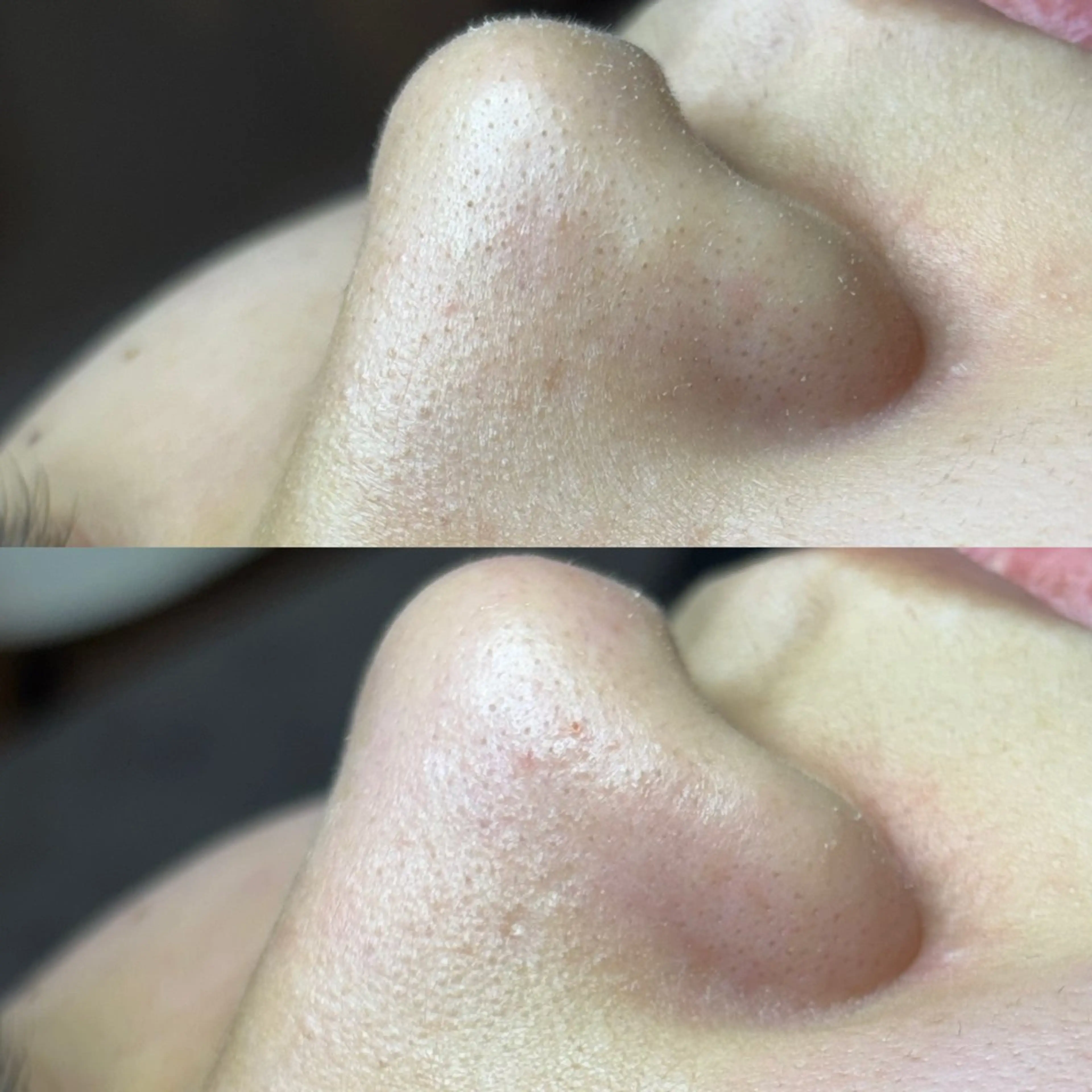 セルフエステエンリケ明石大久保店所属・夕希 毛穴と脱毛特化サロンのエステ・リラクイメージ