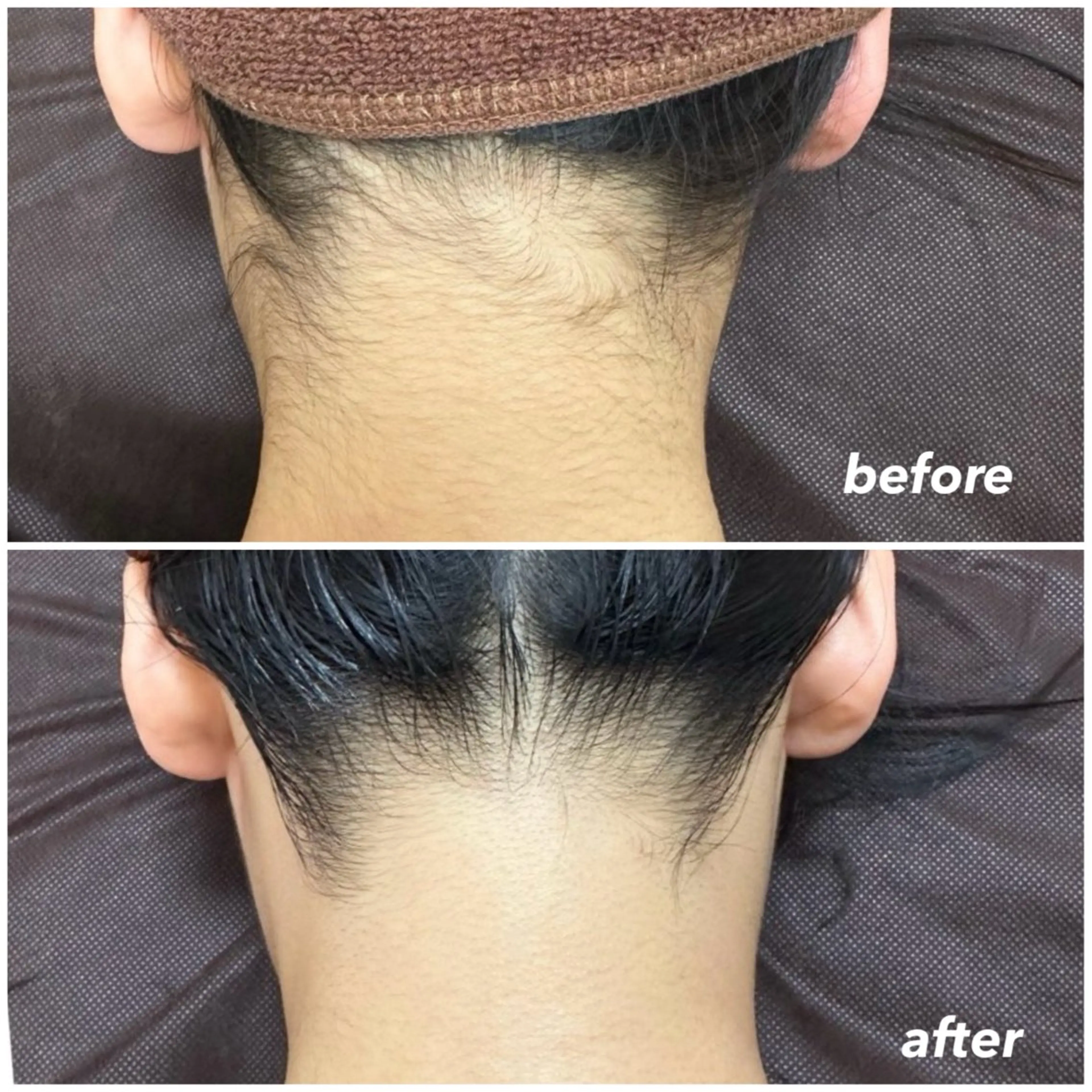 脱毛 ✨韓国肌管理✨ Lisaのエステ・リラクイメージ