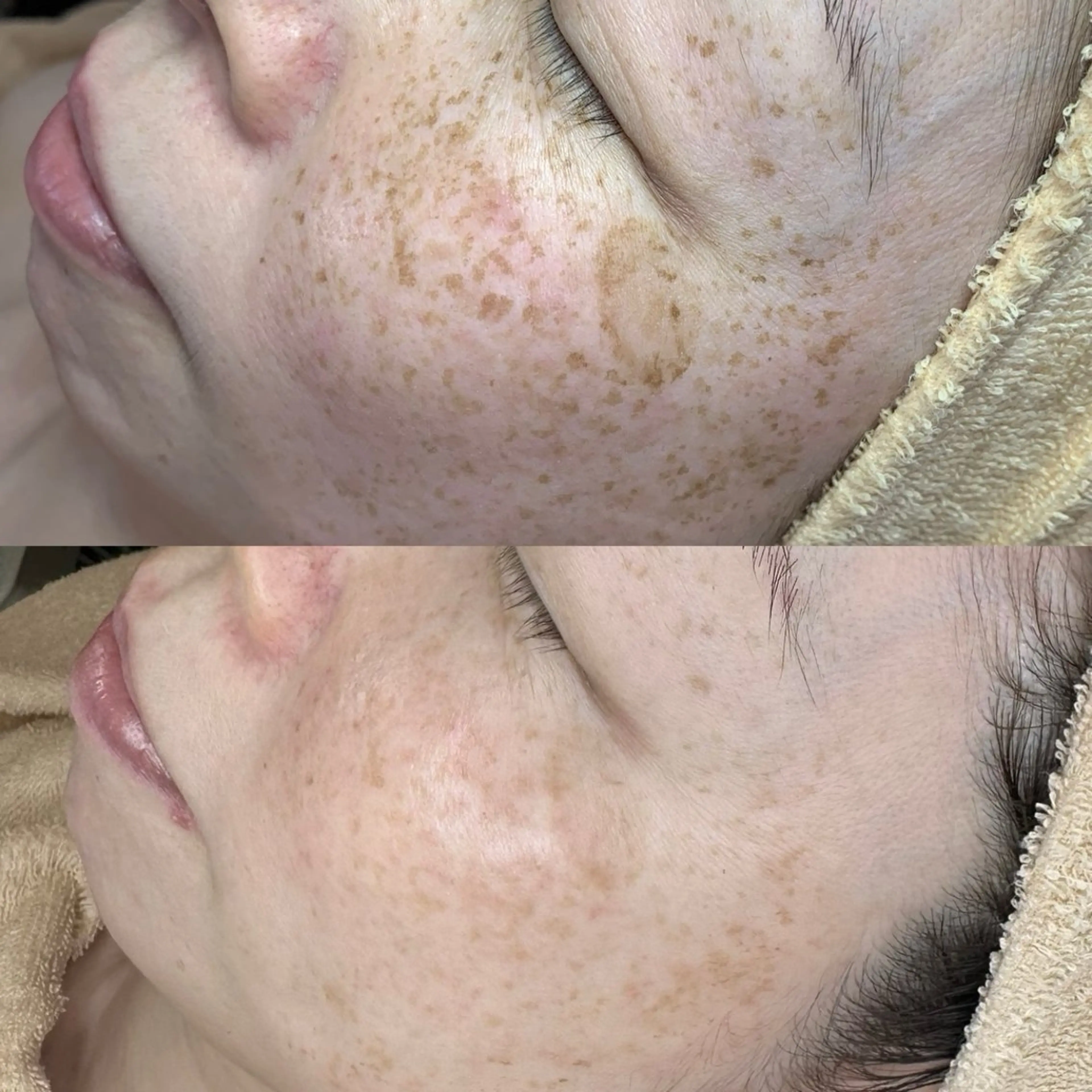 エステ シミケア専門サロン 10POINT.Kのエステ・リラクイメージ