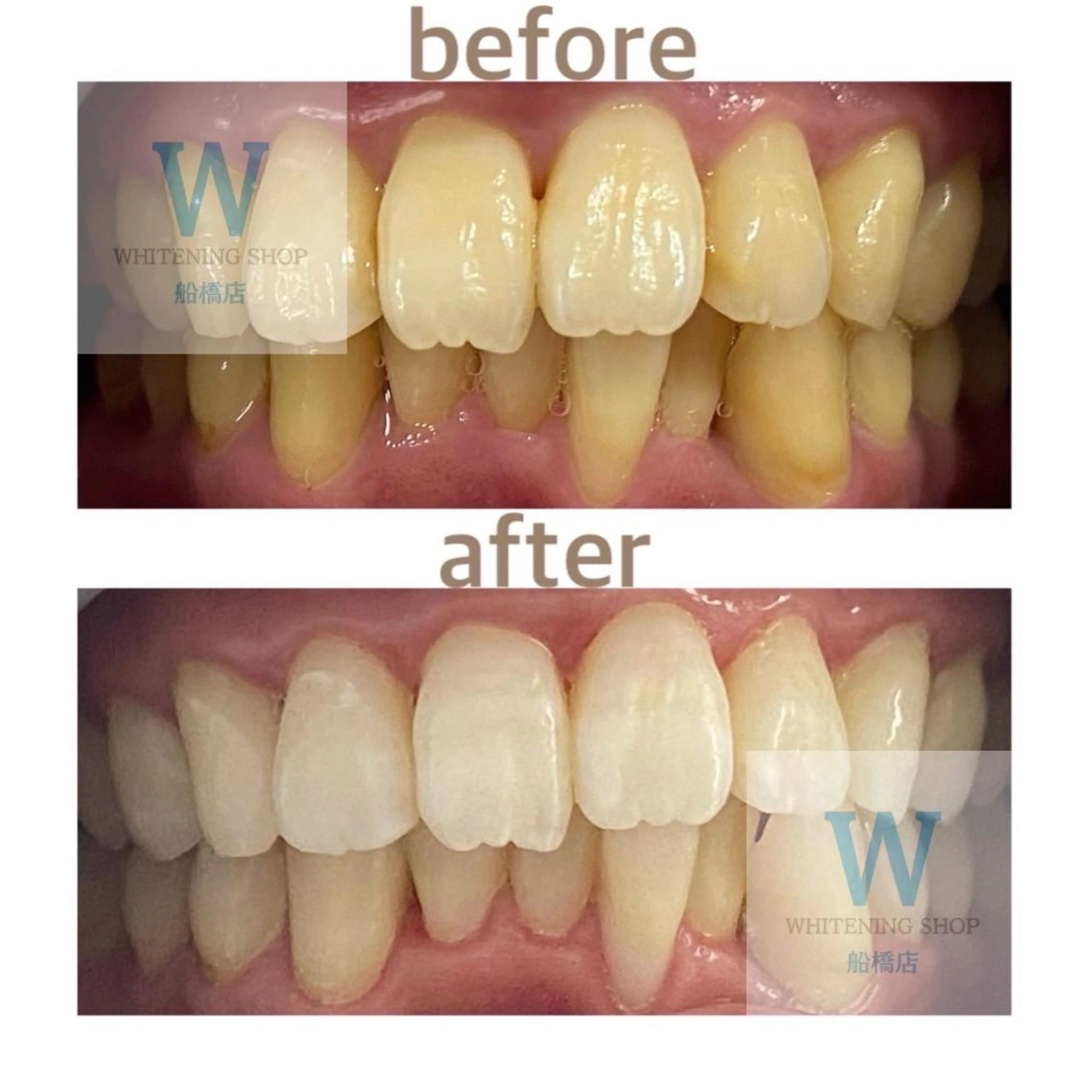 ホワイトニング ショップ船橋２号店のエステ・リラクイメージ