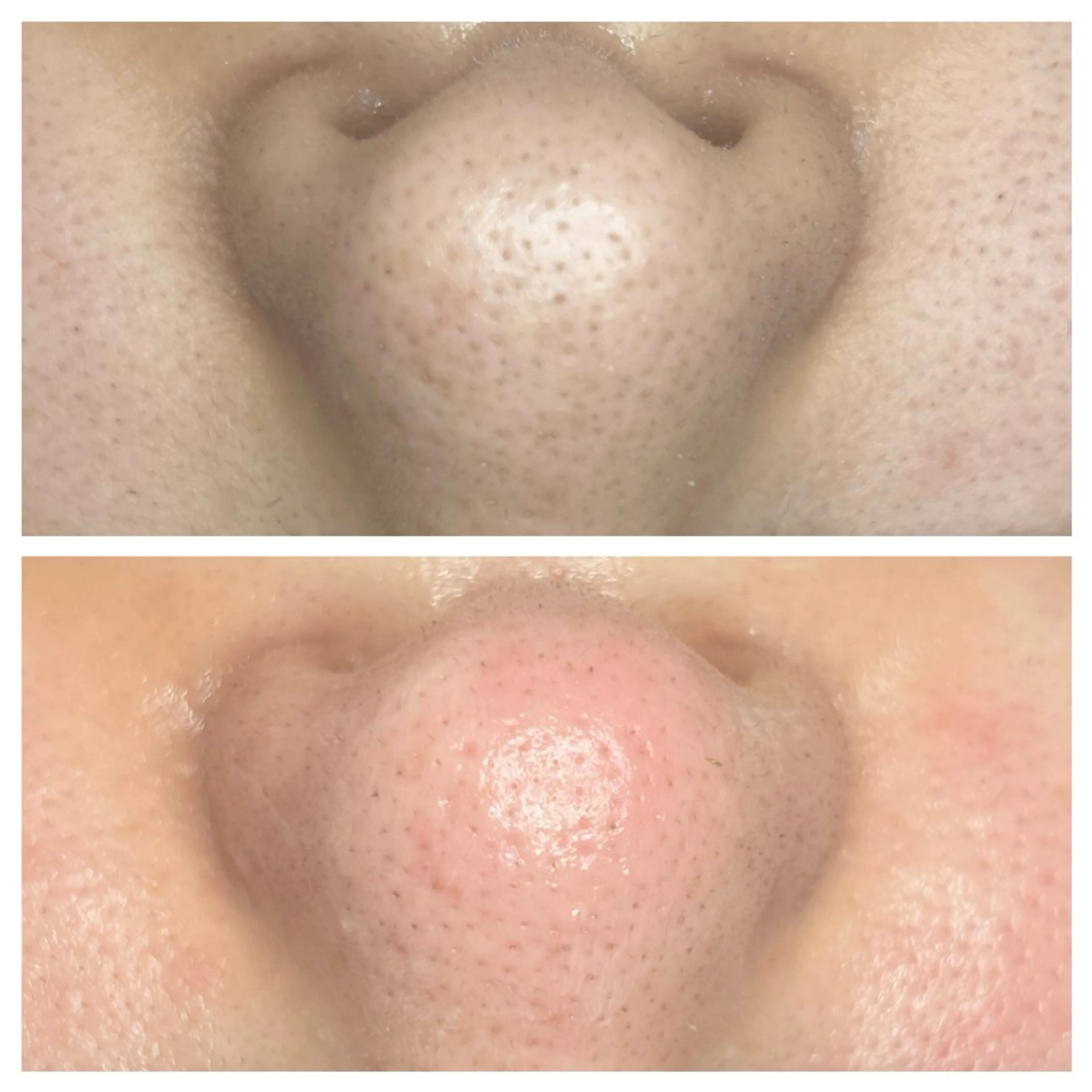 エステ crescent 福寿のマツエク・マツパデザイン