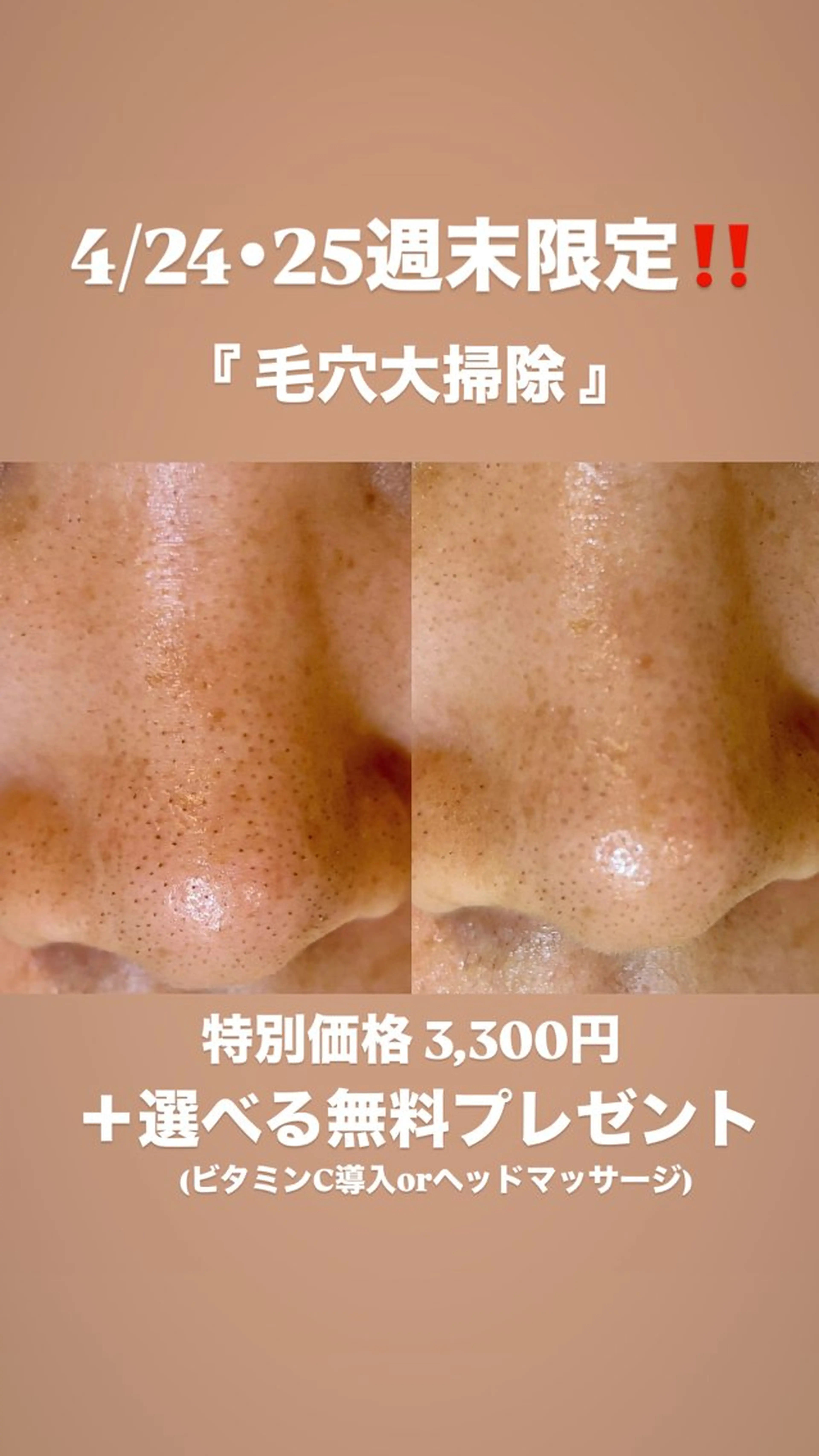 【4/25・26限定‼️】毛穴の大掃除✨毛穴洗浄＋選べる特典（ビタミンC導入orヘッド）付 3,300円の写真