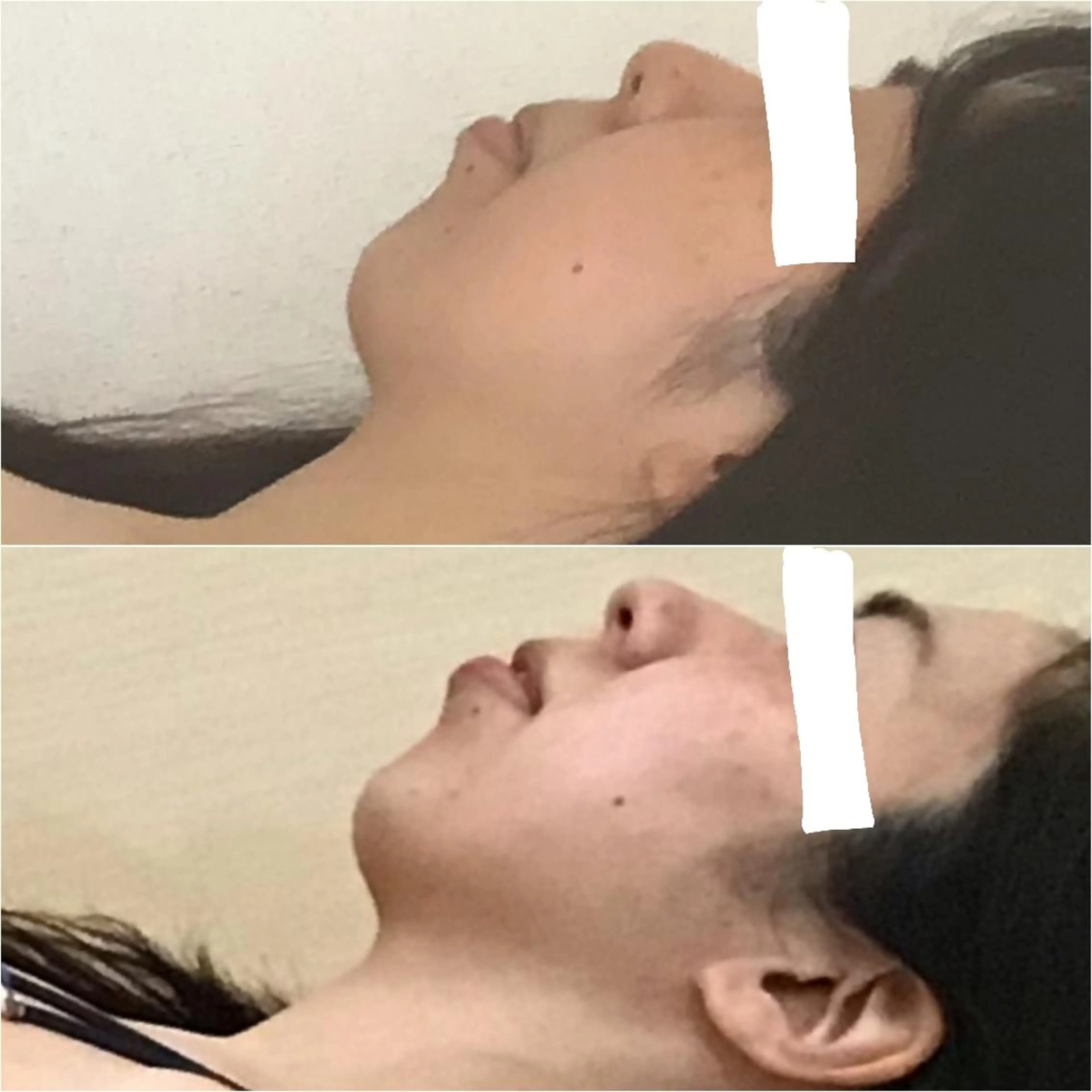 【小顔/リフトアップ】60分お顔の筋膜リリース&静脈マッサージ✨　顎のハリ、フェイスラインに👍の写真