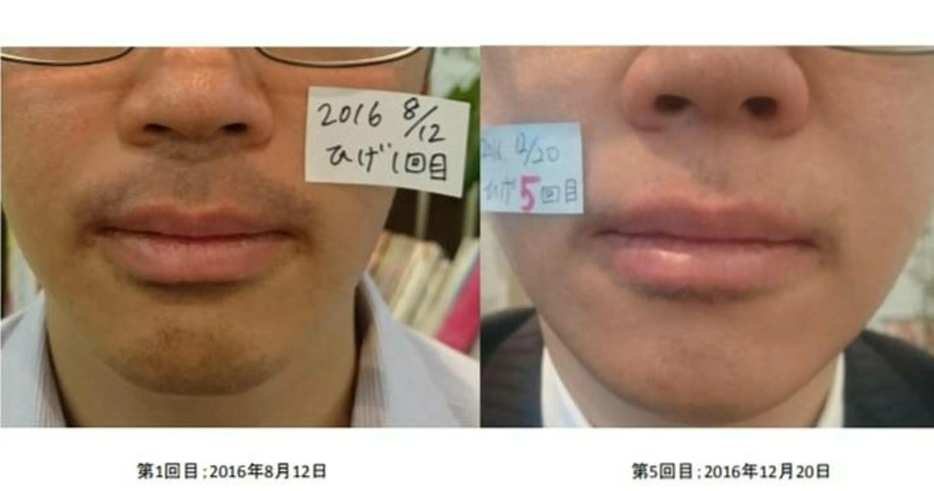 Salon pupa 店長のエステ・リラクイメージ