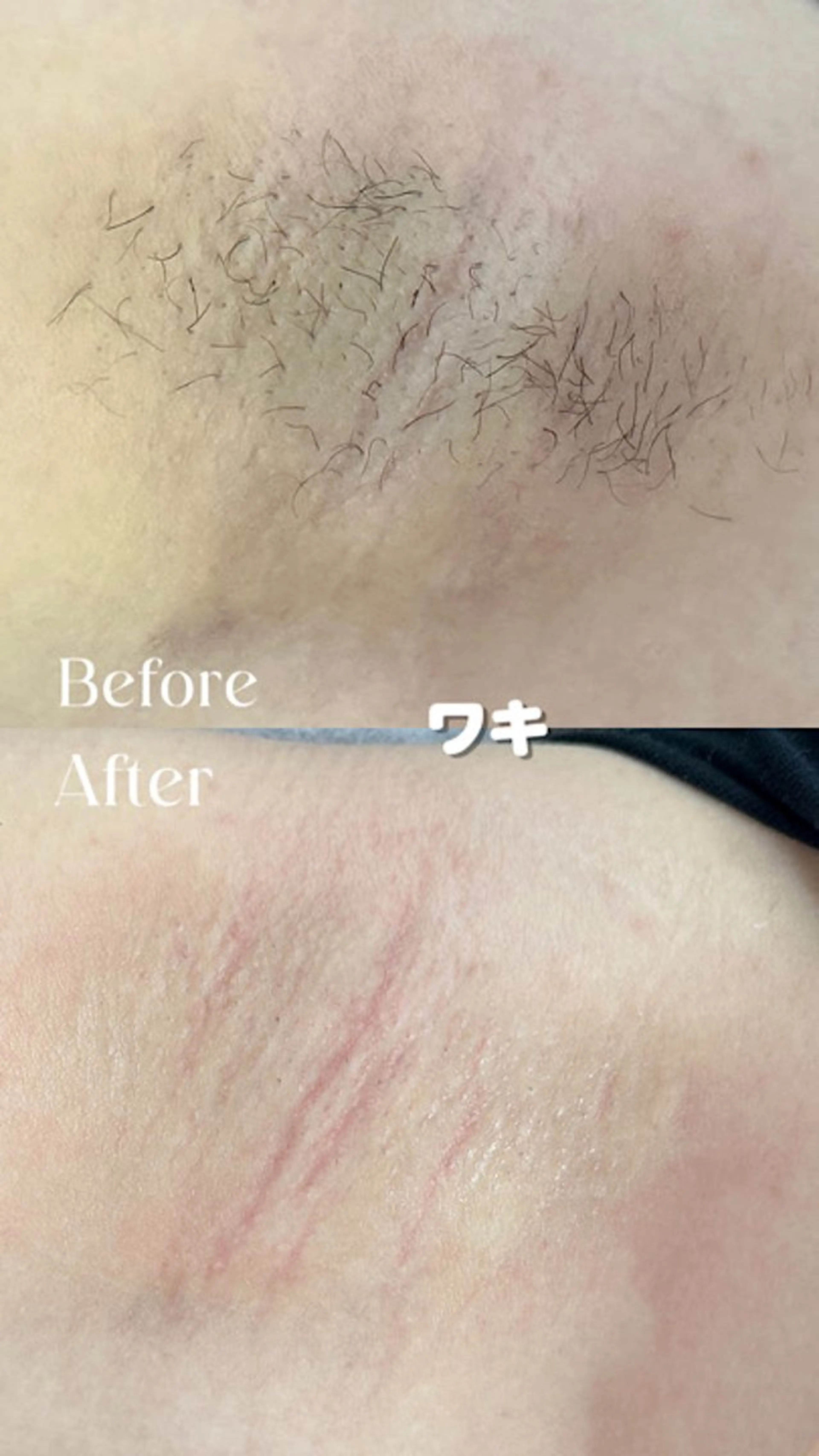 Hitomi シュガーリング豊橋のその他イメージ