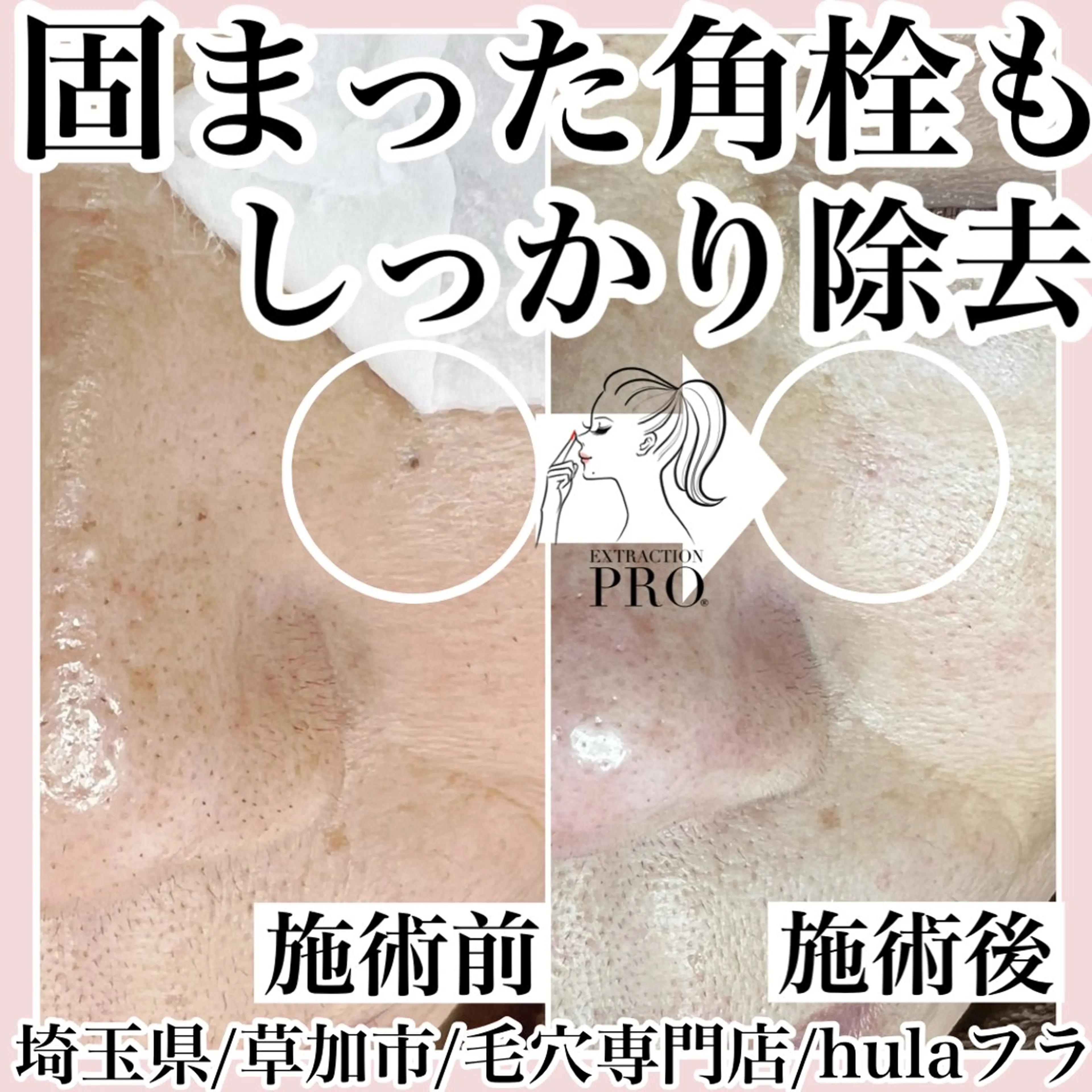 エステ 毛穴専門店hula 杉山智美のエステ・リラクイメージ