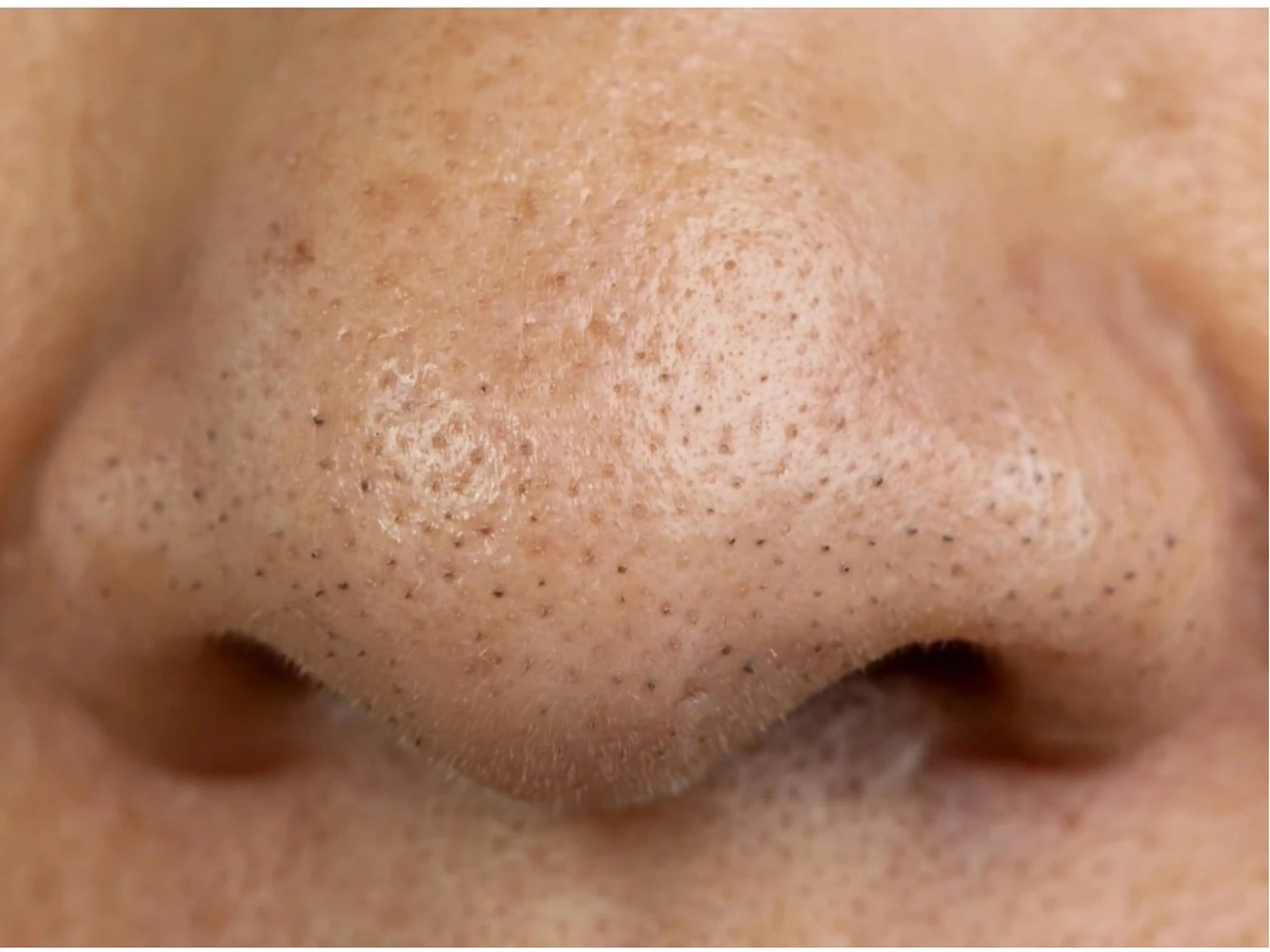 REBORN 赤井愛美のエステ・リラクイメージ