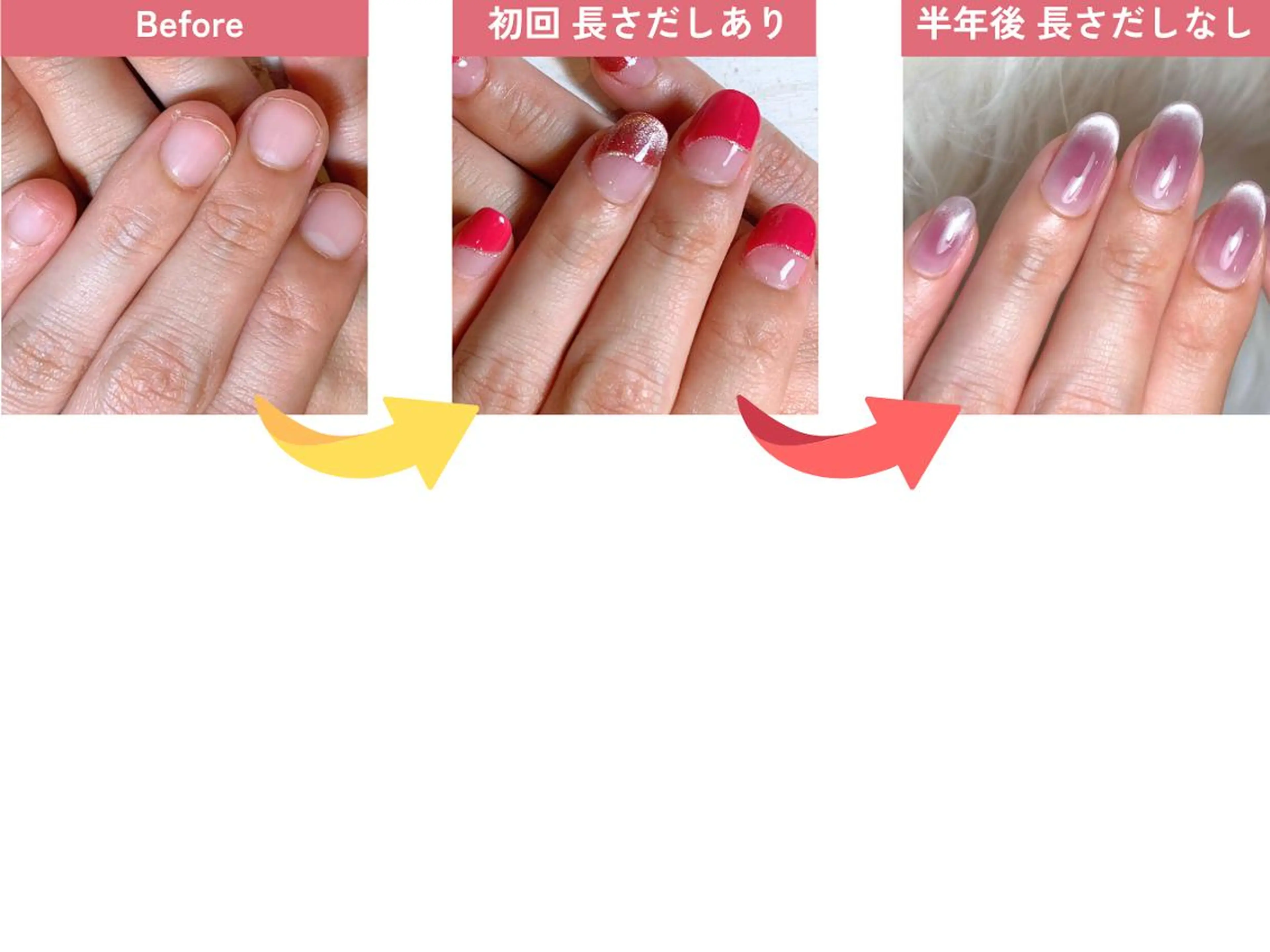 ネイル 深爪矯正・自爪育成 ネイルサロンアモまいのネイルデザイン