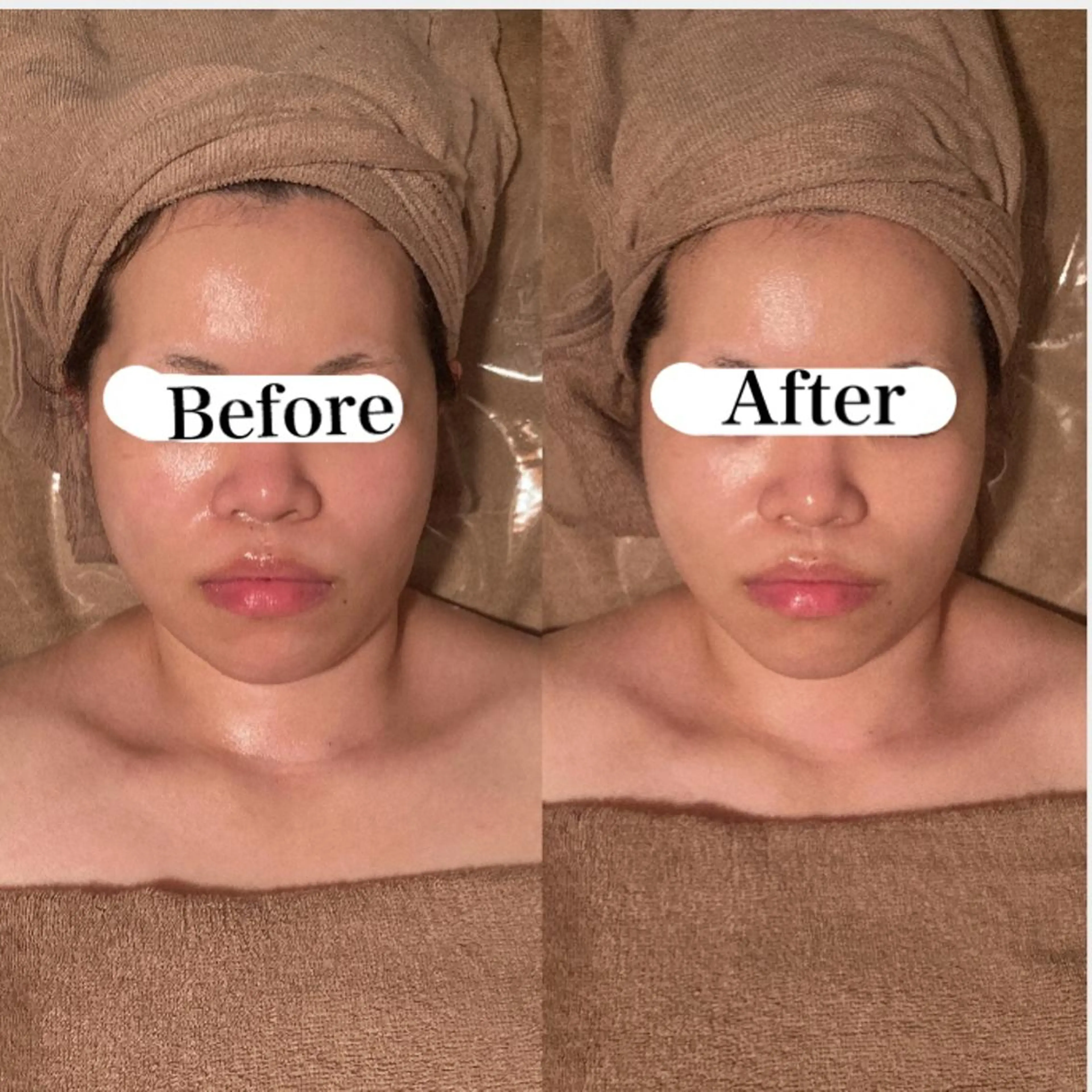 エステ リラク Ｂ&H所属・頭痛肩こり改善/小顔 サロンB&H心斎橋のエステ・リラクイメージ