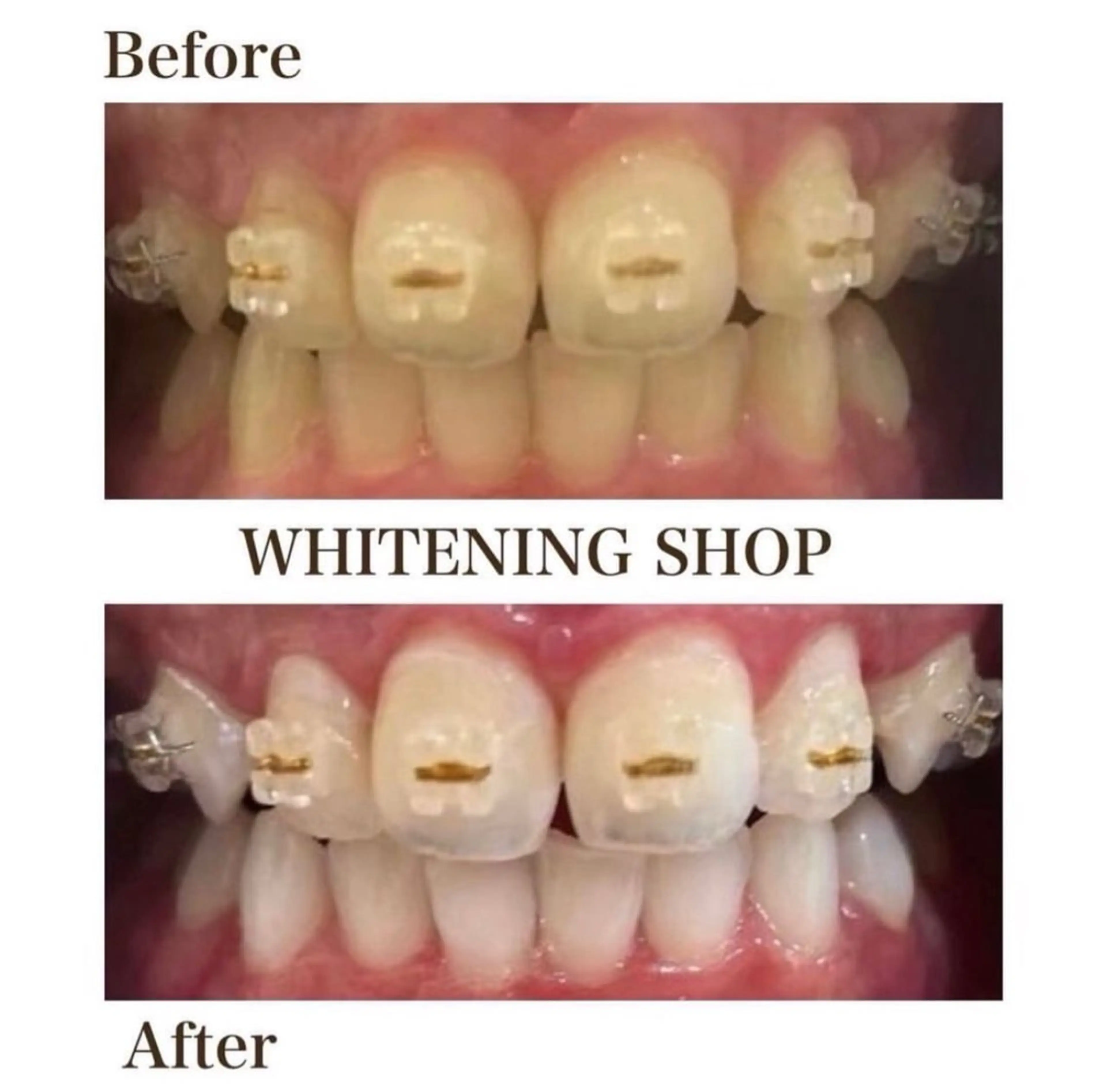 ホワイトニング ショップ伊丹店のその他イメージ