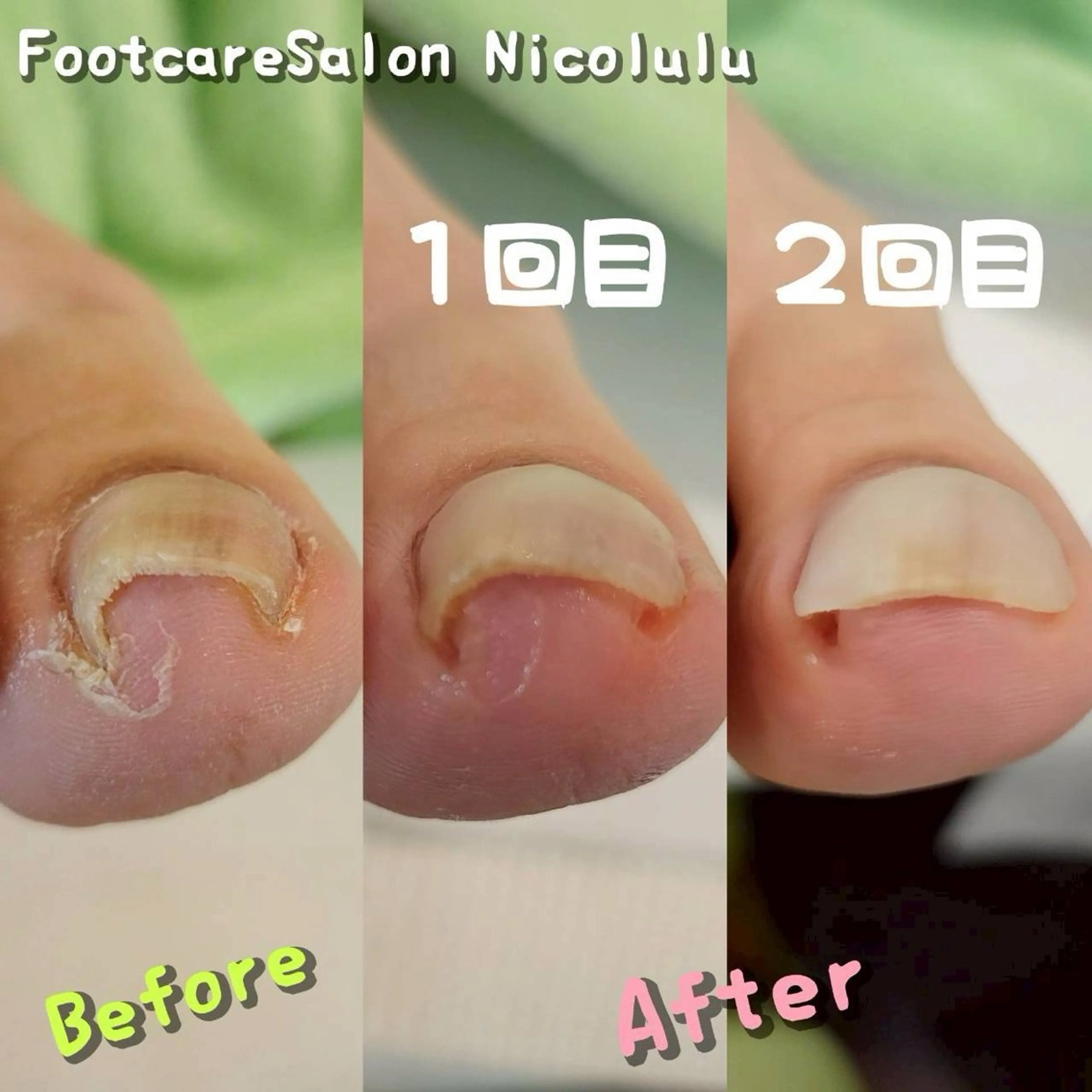 リラク 足トラブル専門 ニコルル金沢のエステ・リラクイメージ