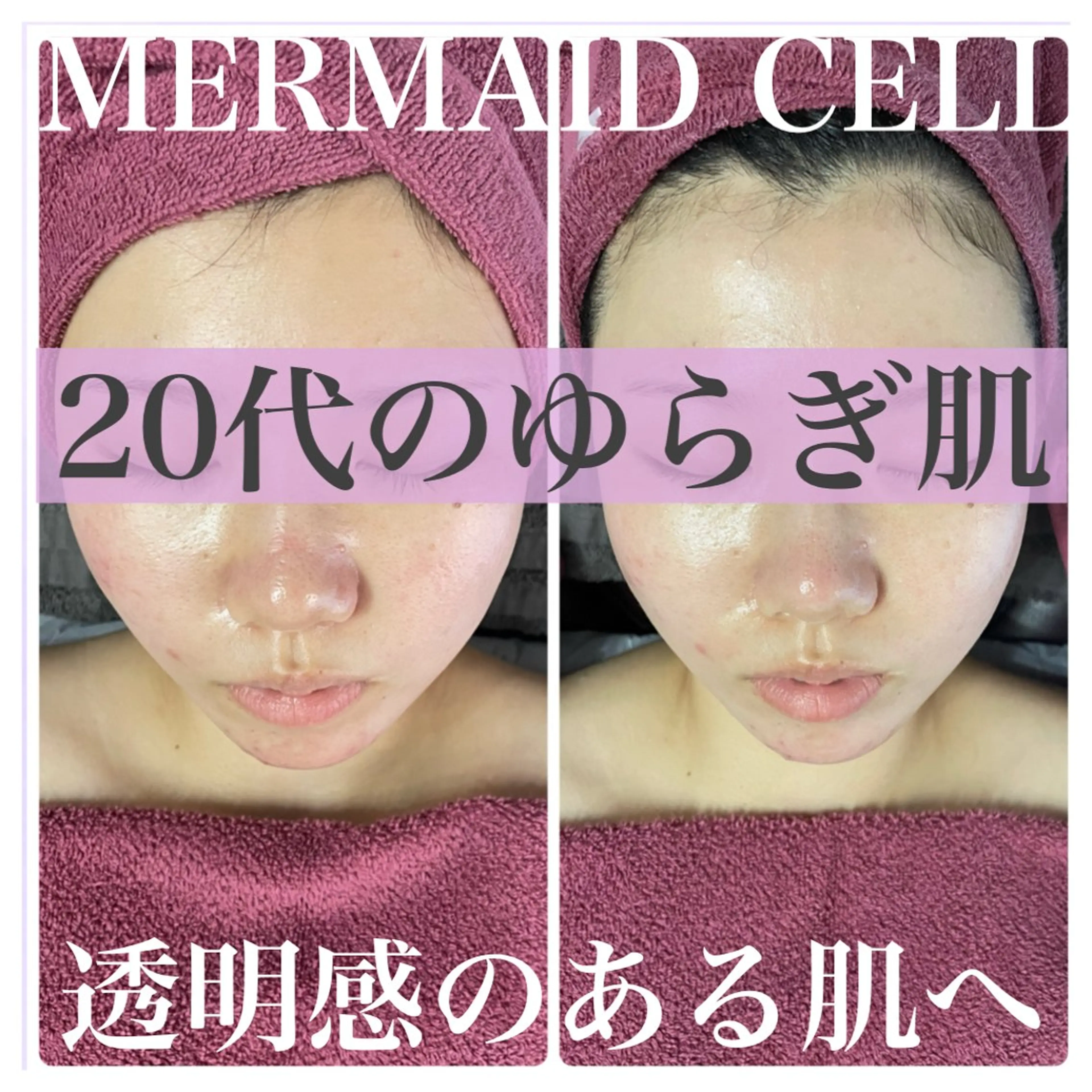 深層筋×筋膜リリース 首肩こり/むくみのエステ・リラクイメージ