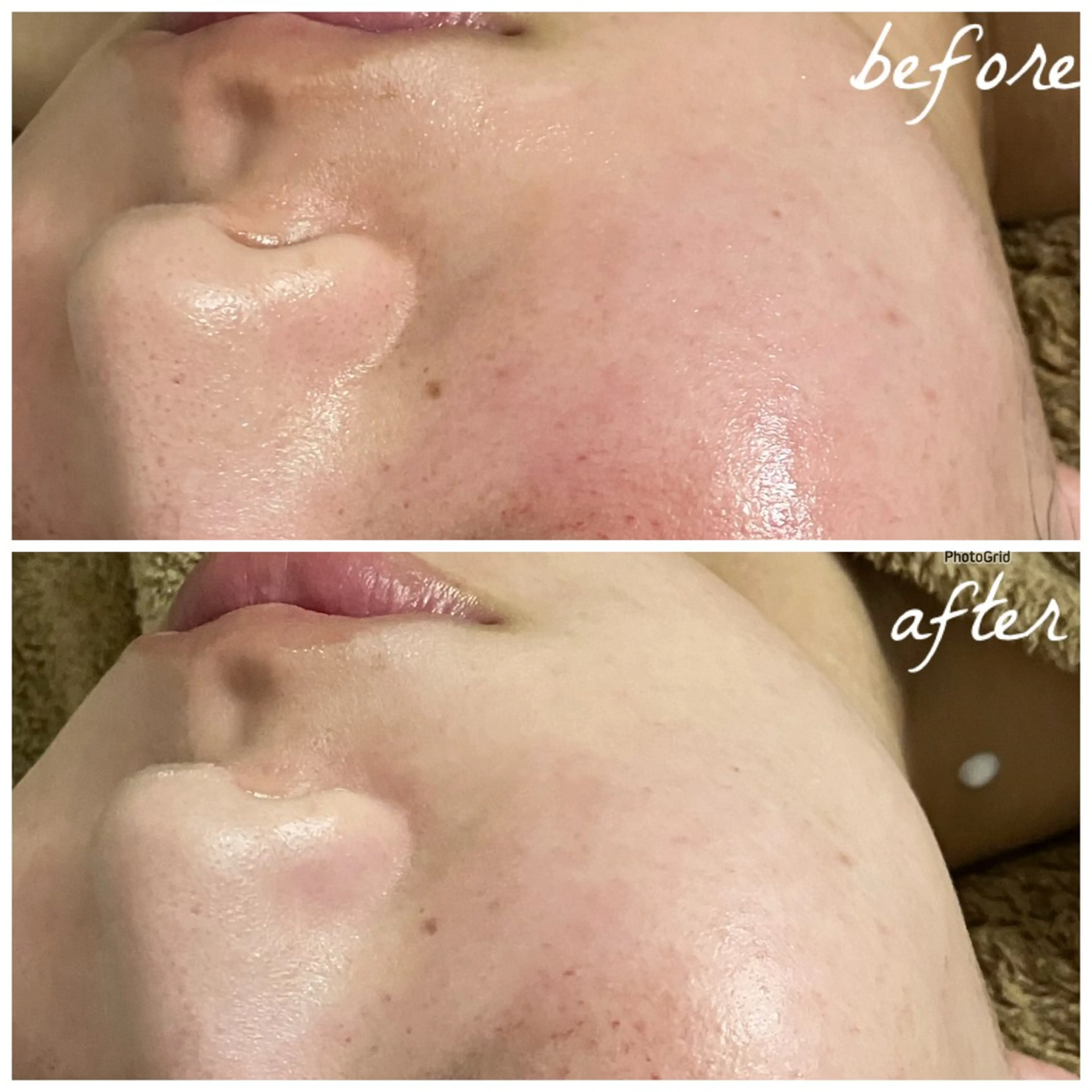 メンズ エステ メナード岐阜茜部 杉浦のエステ・リラクイメージ