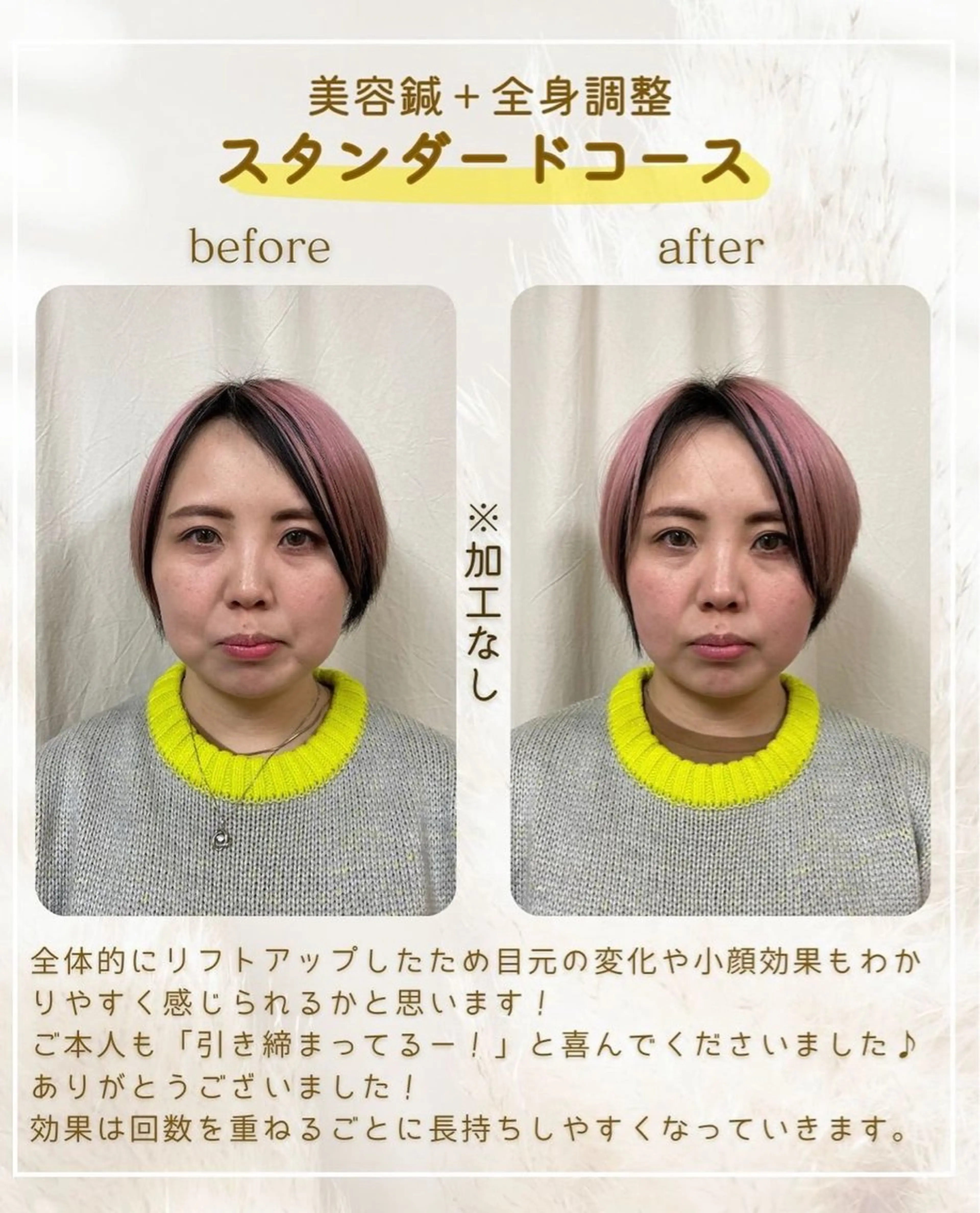 エステ 鍼灸 PALMのエステ・リラクイメージ