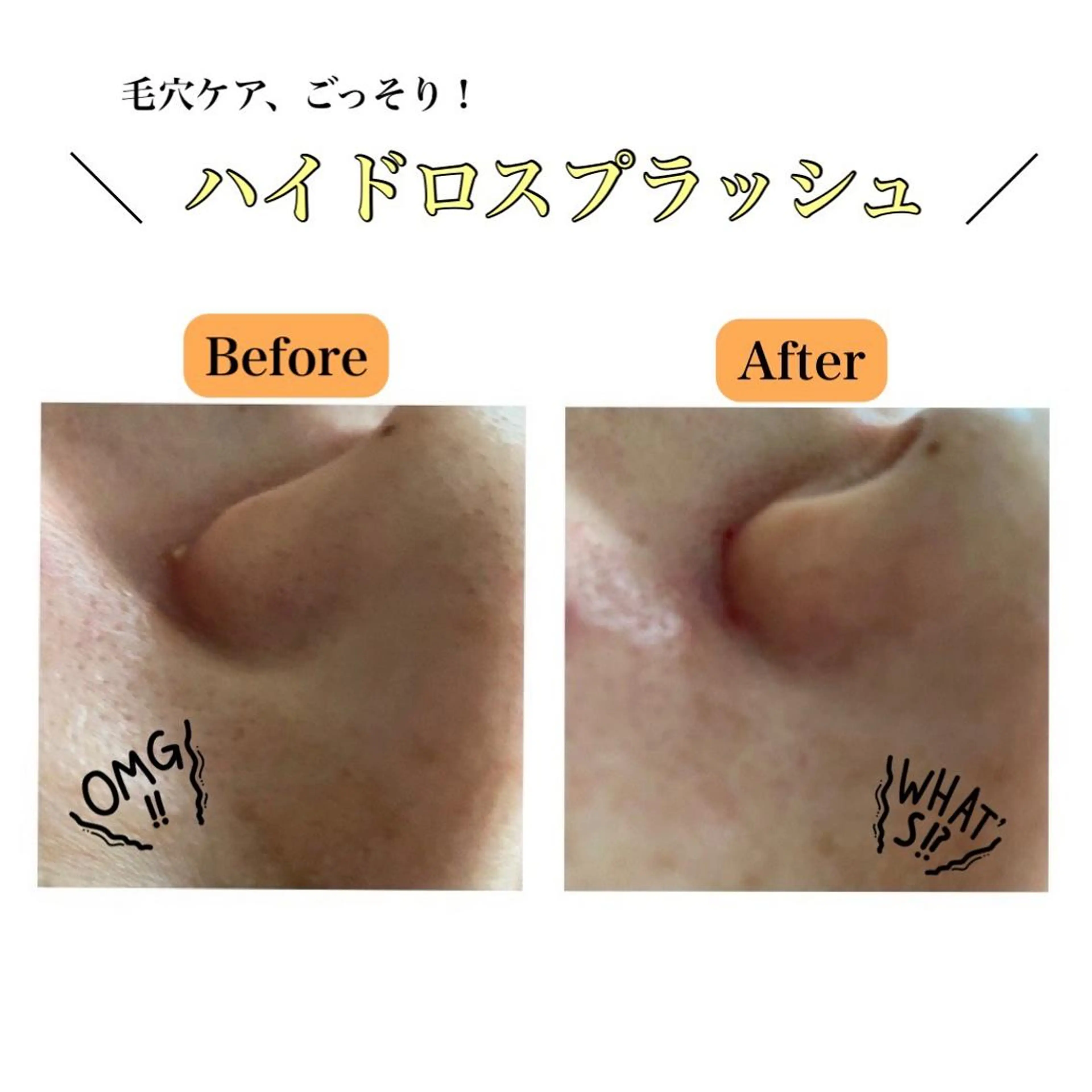 Chalon所属・REVI取扱・肌悩み 毛穴Chalonのエステ・リラクイメージ