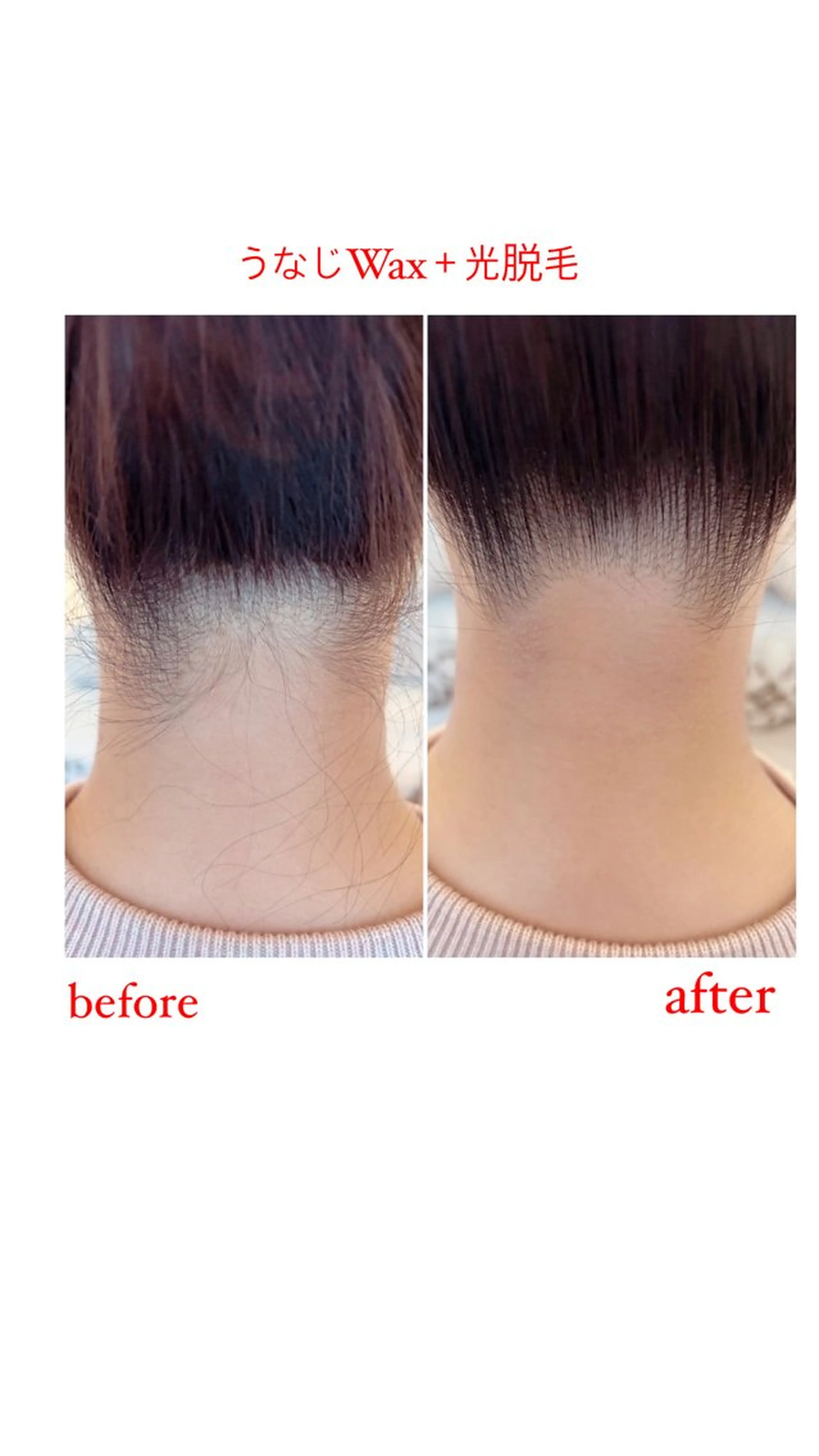 ワックス脱毛🌈 ESPOIRnocoのエステ・リラクイメージ