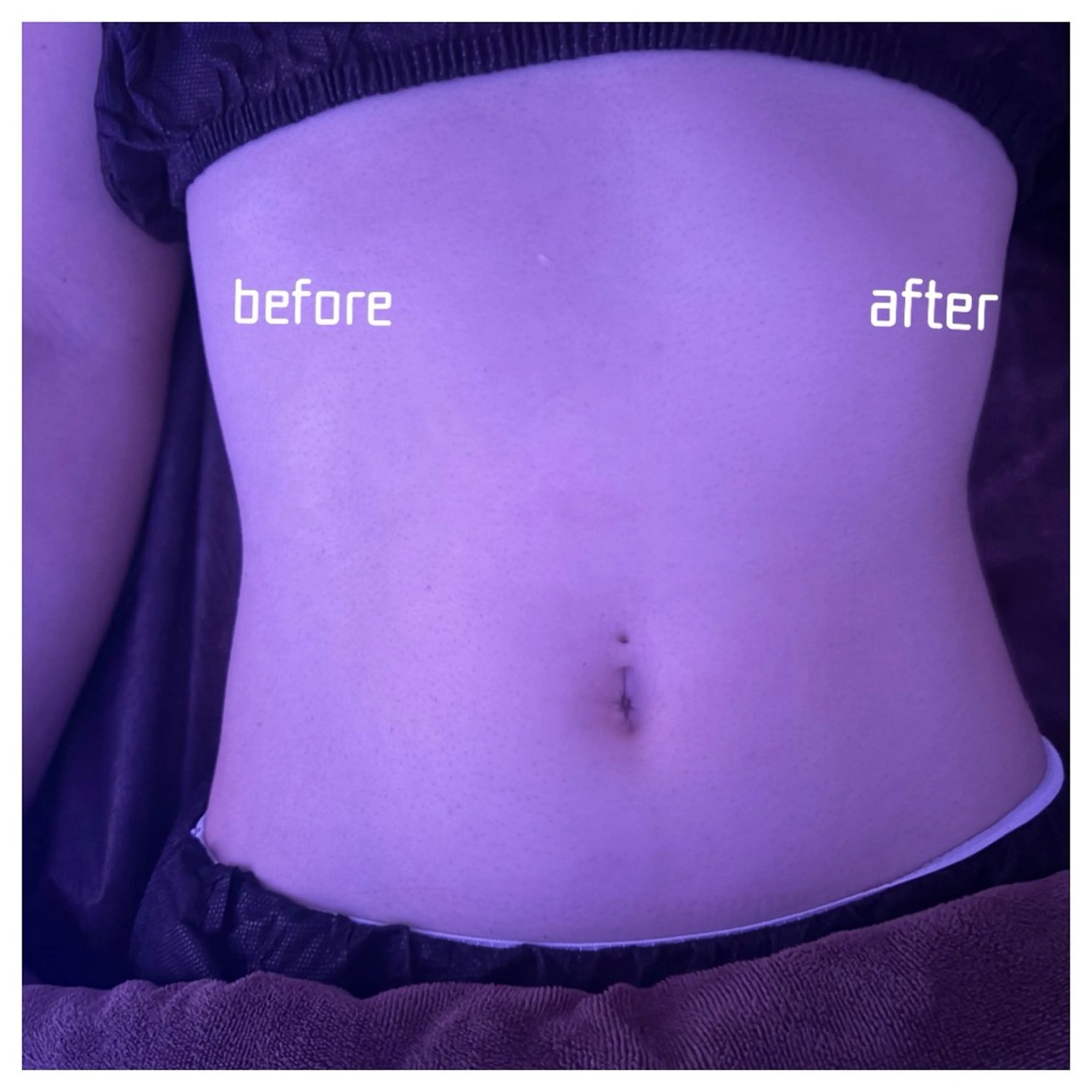 🌿お得なトータルメニュー🌿　　　　　　体と頭同時ケアしたい時に❣️    彫刻リンパ®︎ボディ+ヘッドスパ　120分の写真