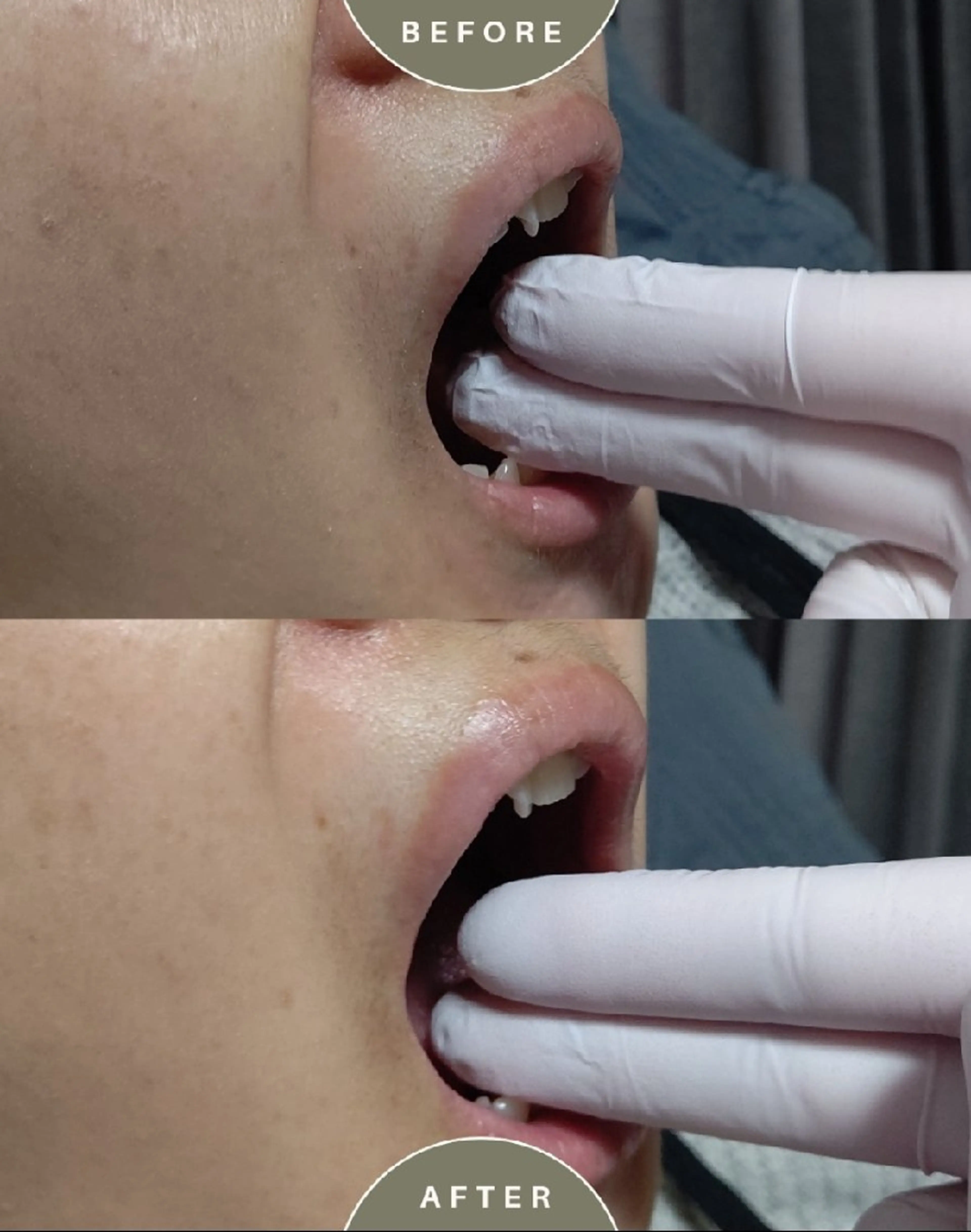 はなえみの森 上戸千瑞のエステ・リラクイメージ