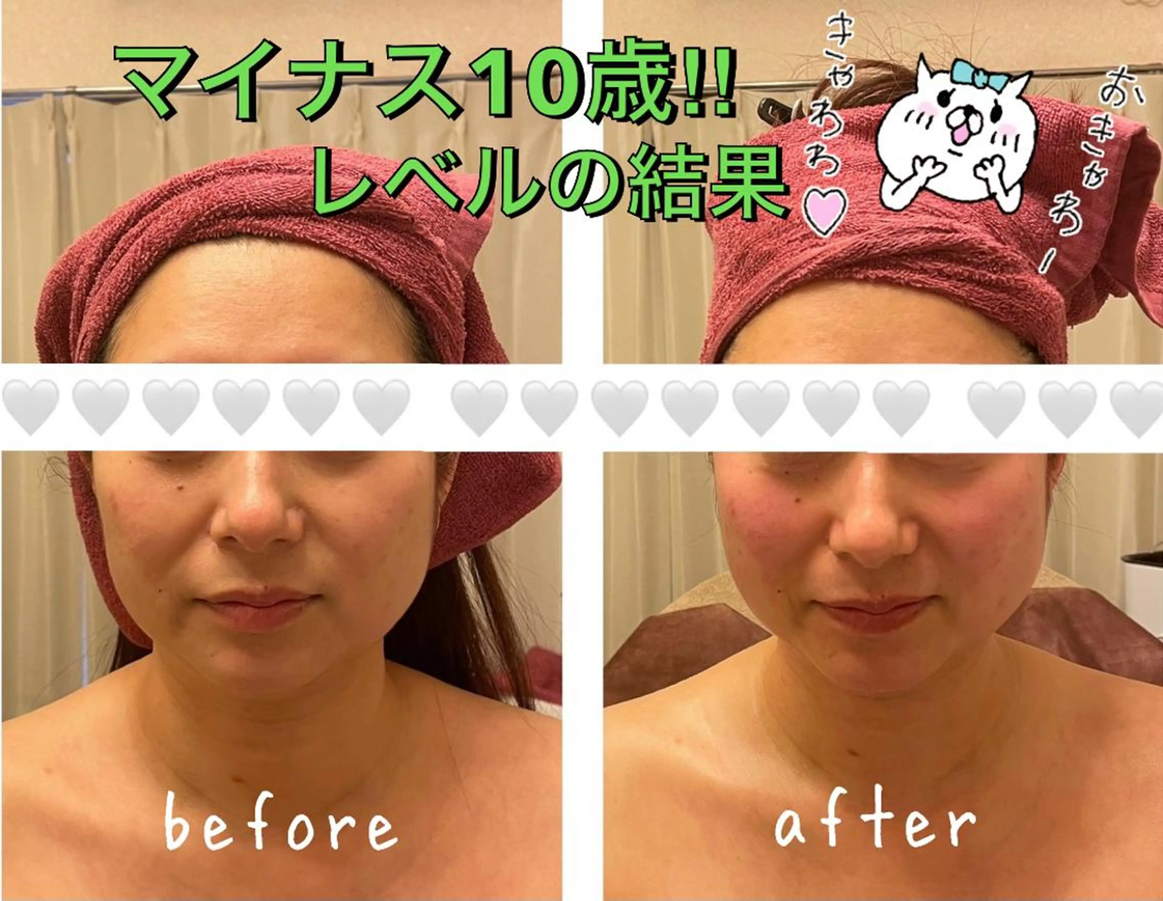 35歳からの エイジングケアサロンのエステ・リラクイメージ