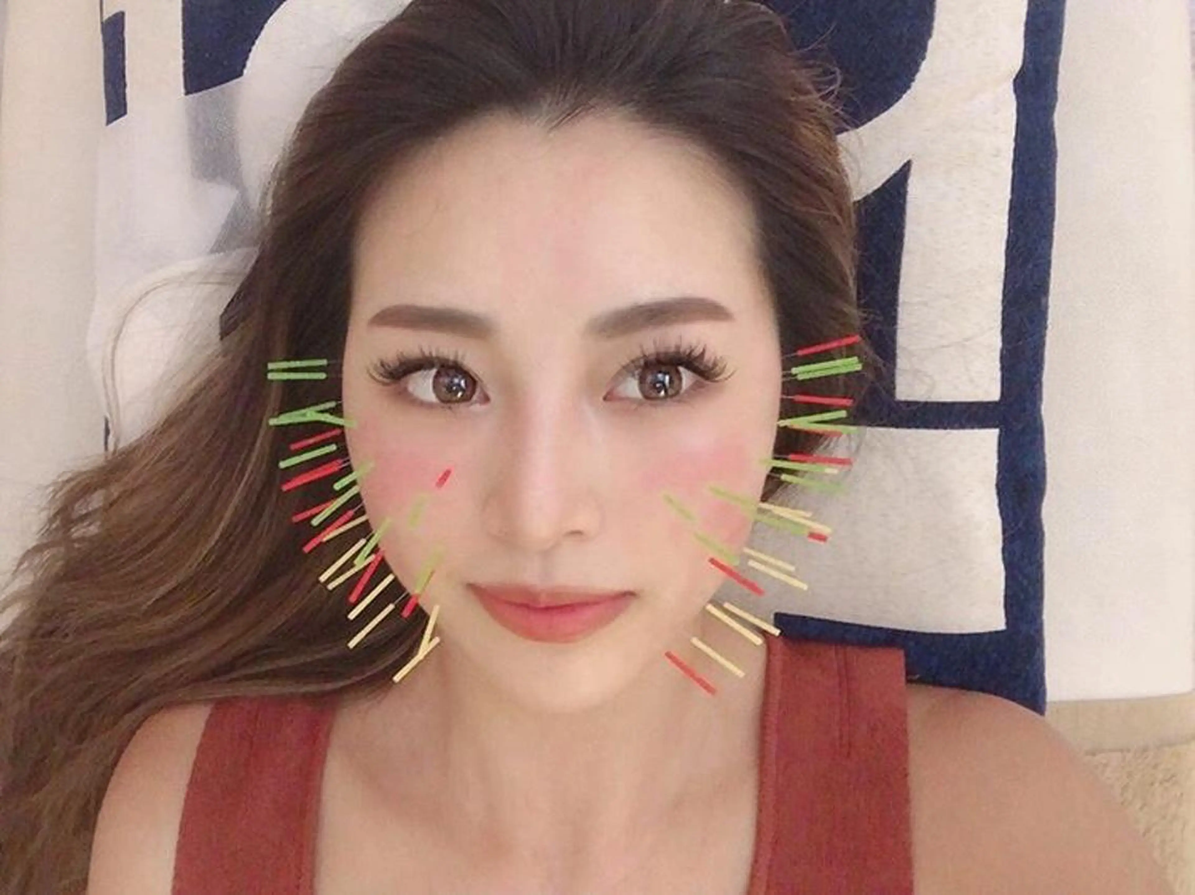 鍼灸整骨院Refine所属・鍼灸 Refineのその他イメージ